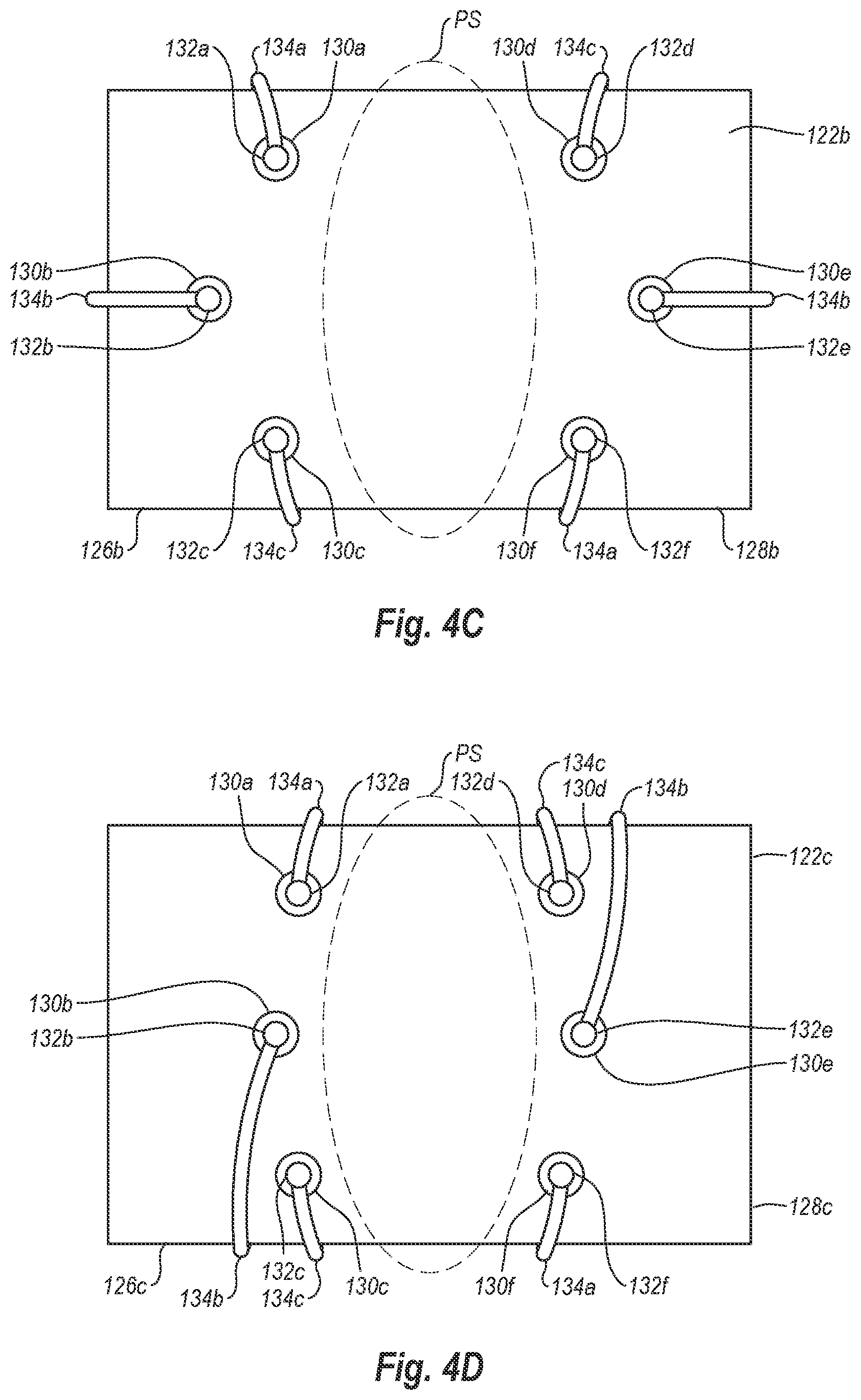 Patent US12376845 Figure 6 – Systems, methods, and devices for closing holes in body lumens