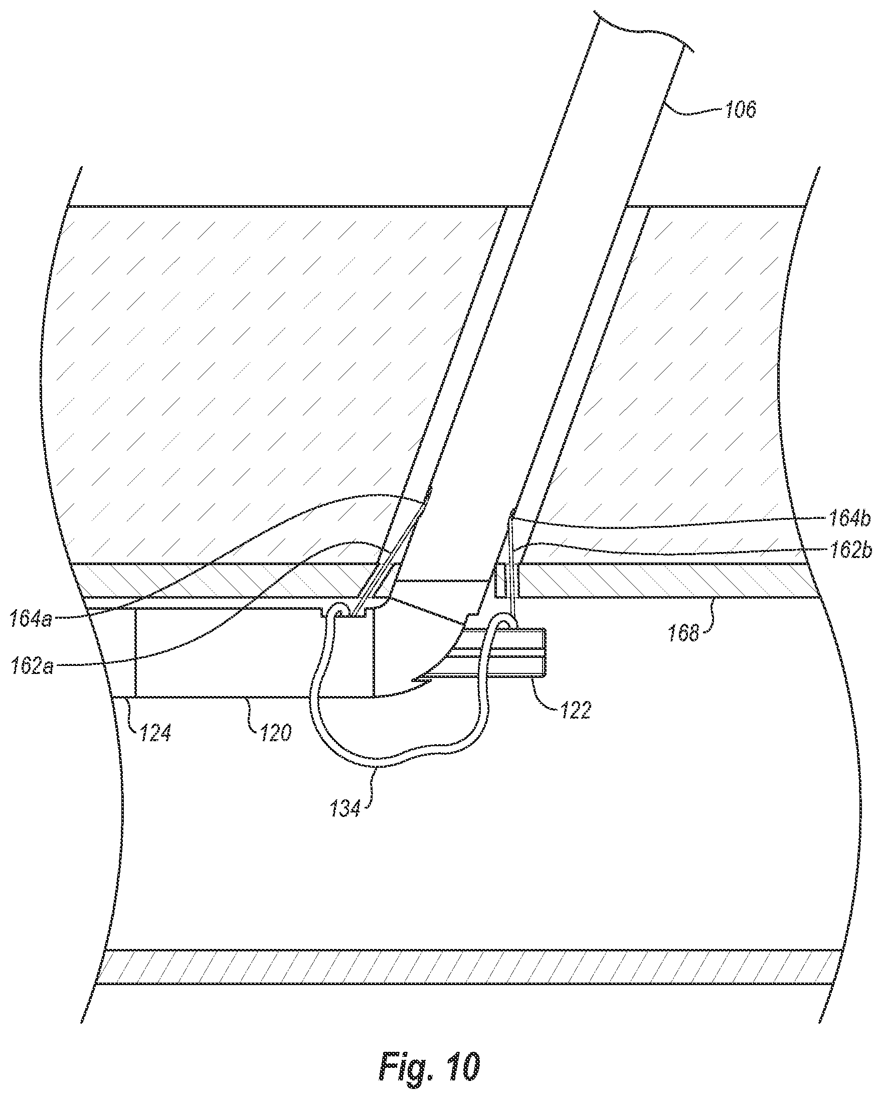 Patent US12376845 Figure 13 – Systems, methods, and devices for closing holes in body lumens