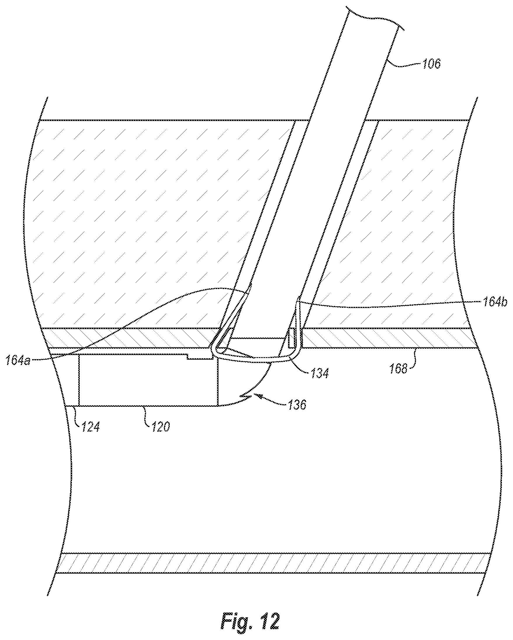 Patent US12376845 Figure 15 – Systems, methods, and devices for closing holes in body lumens