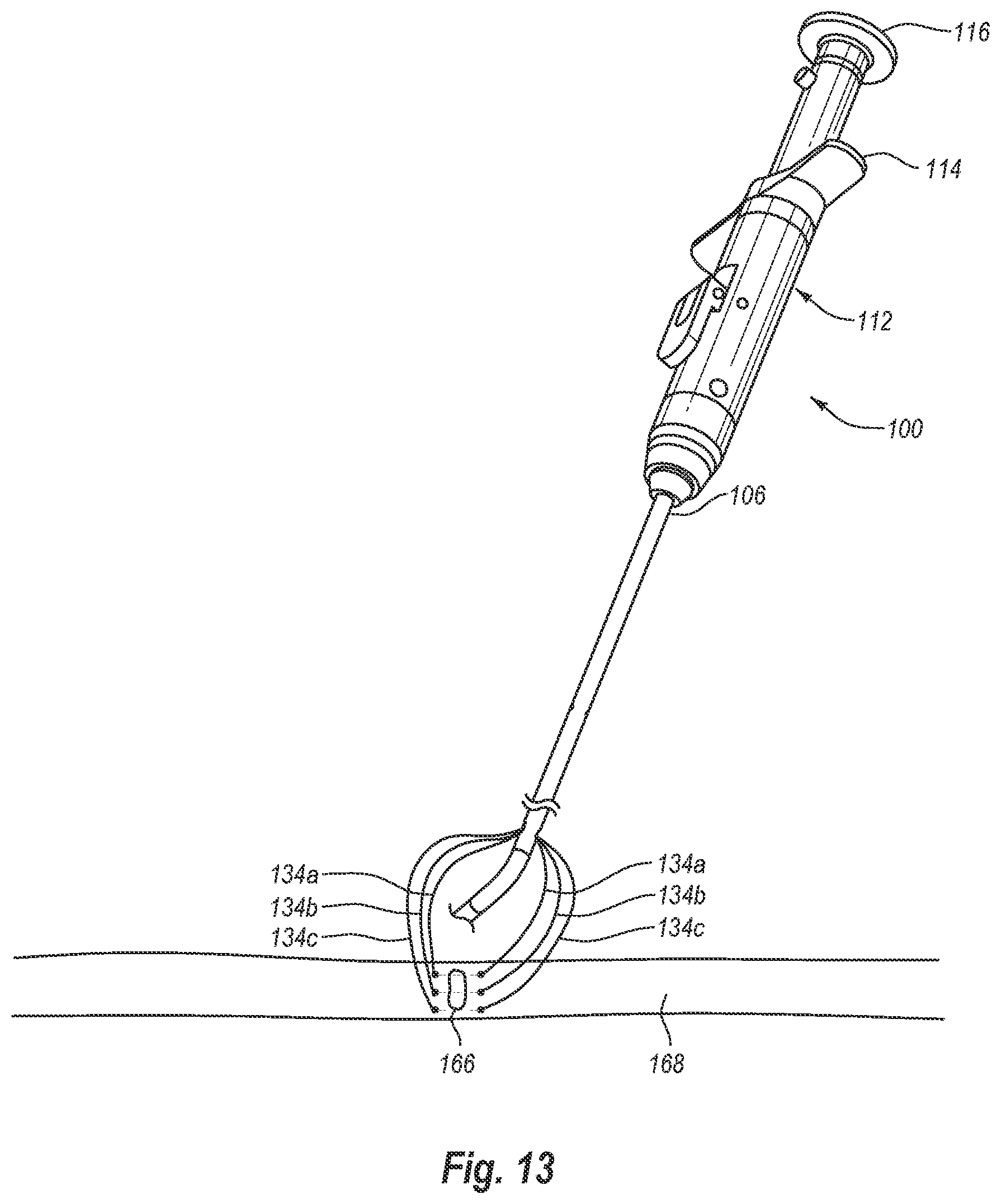Patent US12376845 Figure 16 – Systems, methods, and devices for closing holes in body lumens