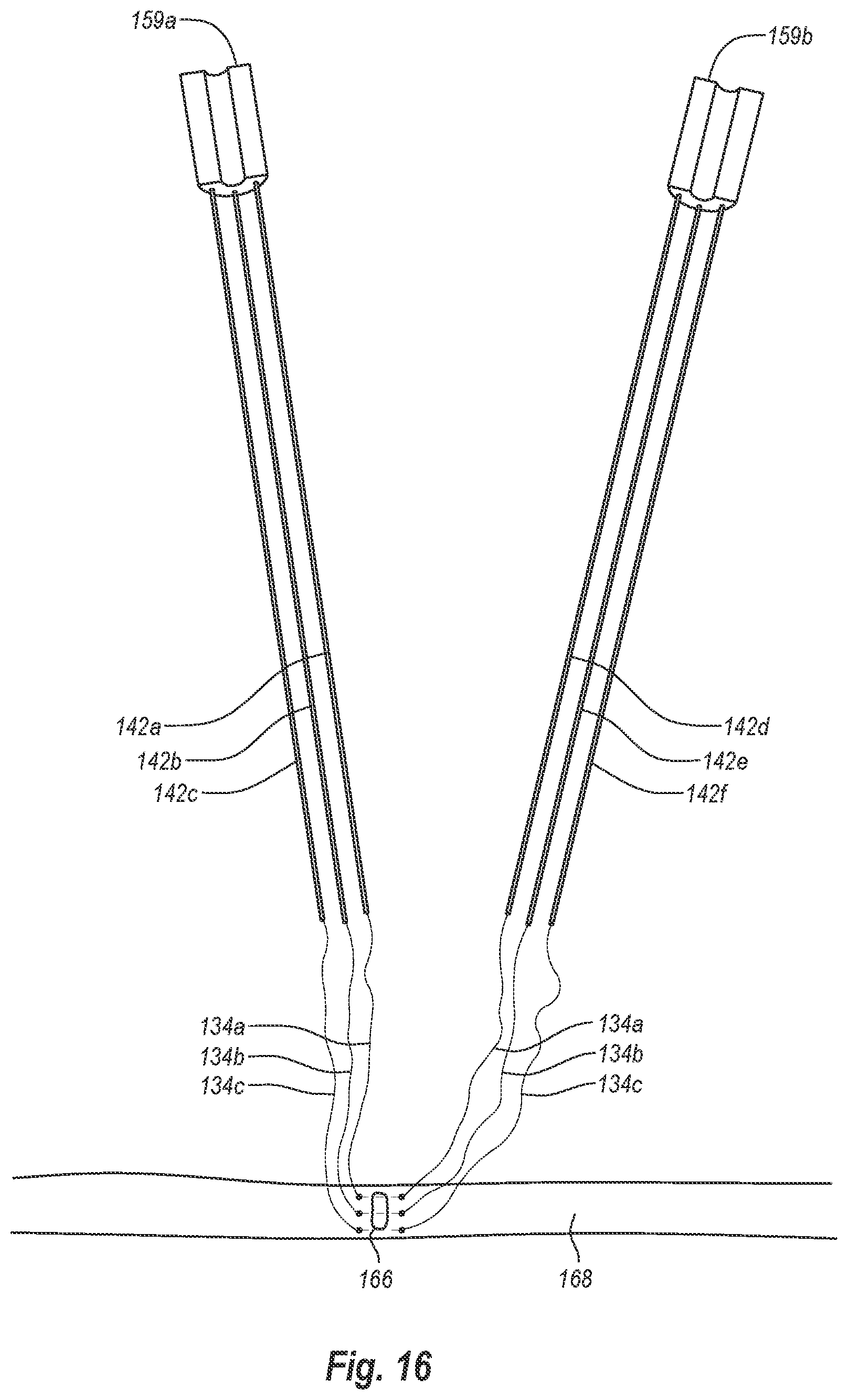 Patent US12376845 Figure 19 – Systems, methods, and devices for closing holes in body lumens