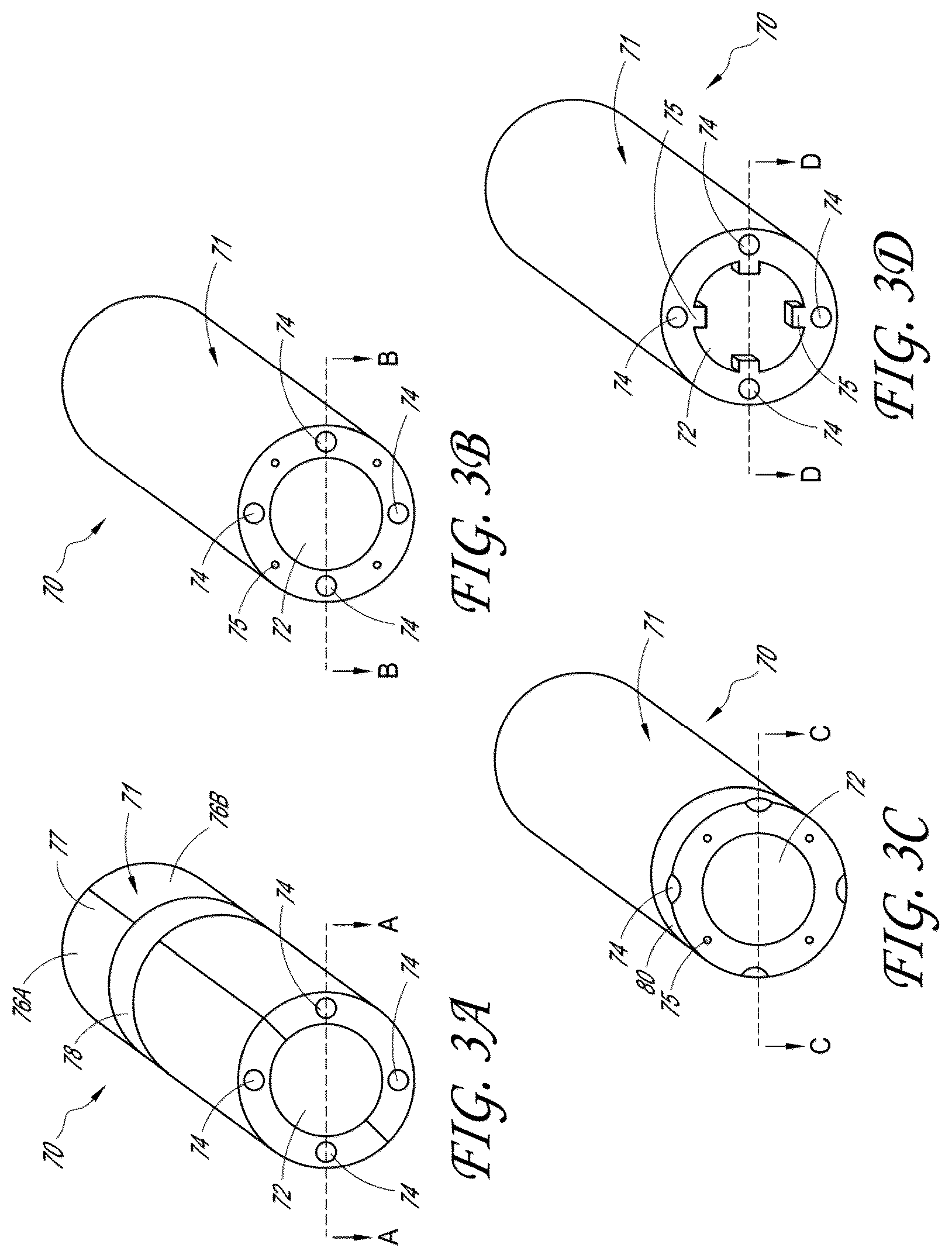 Patent US12376846 Figure 4 – Suturing devices and methods for suturing an anatomic structure