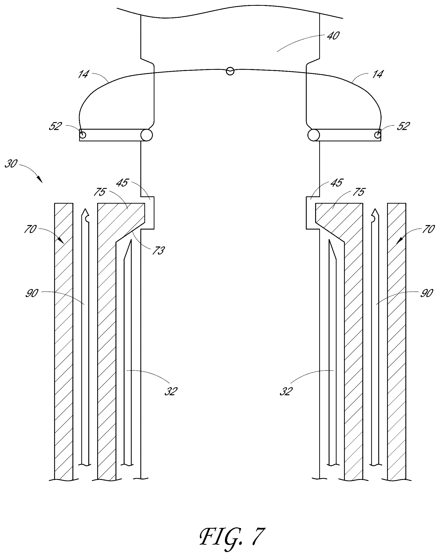 Patent US12376846 Figure 7 – Suturing devices and methods for suturing an anatomic structure