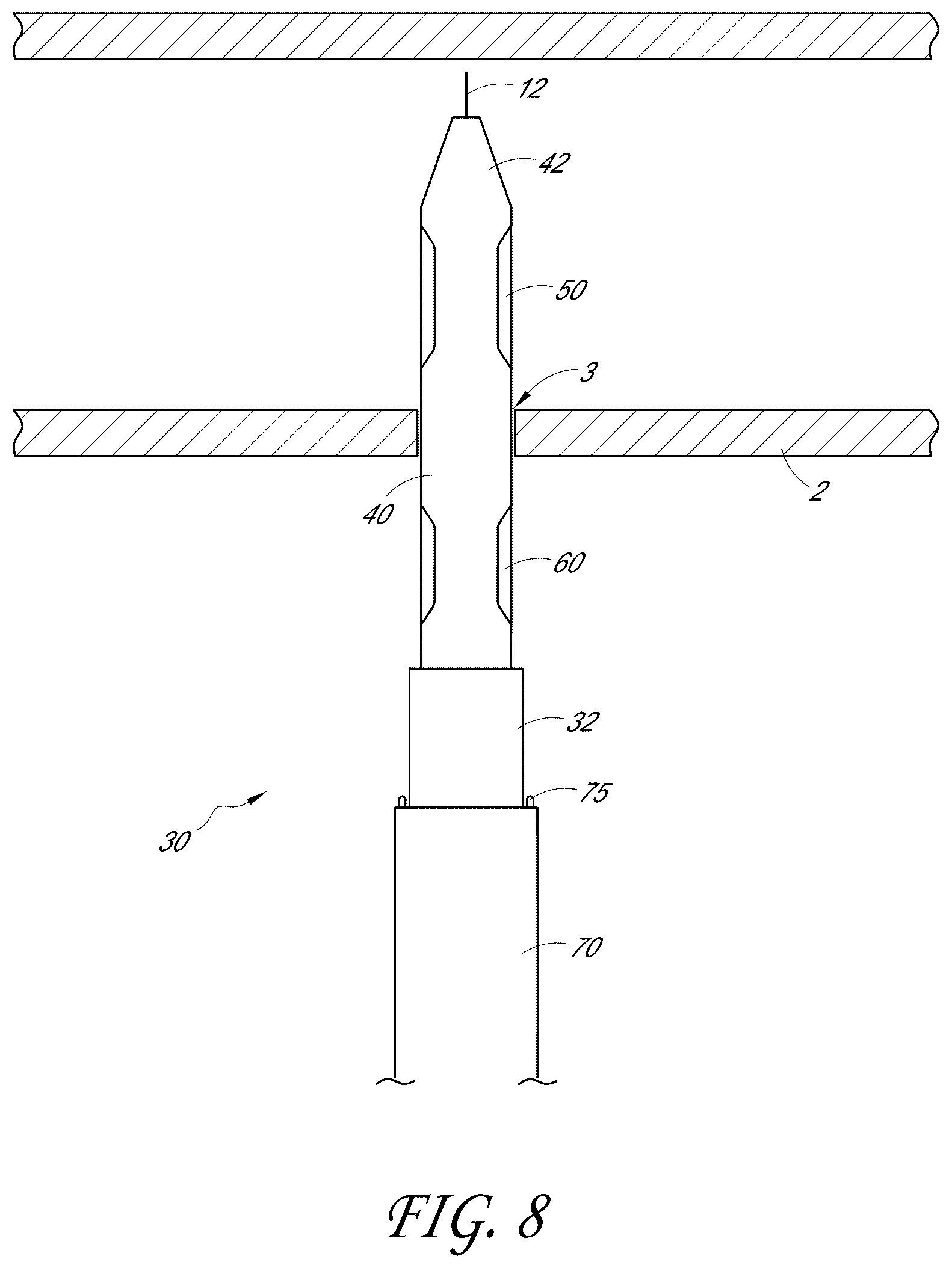 Patent US12376846 Figure 8 – Suturing devices and methods for suturing an anatomic structure