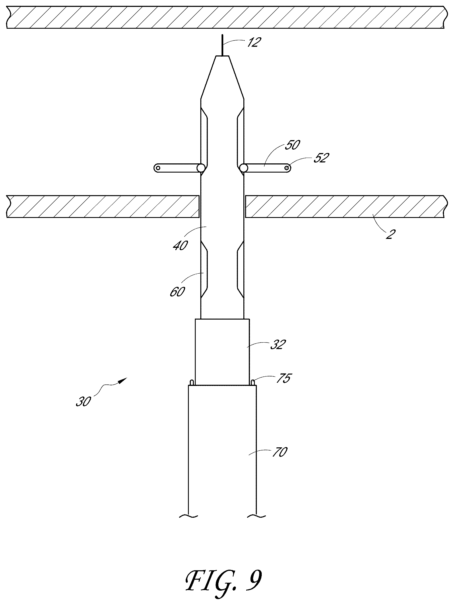 Patent US12376846 Figure 9 – Suturing devices and methods for suturing an anatomic structure