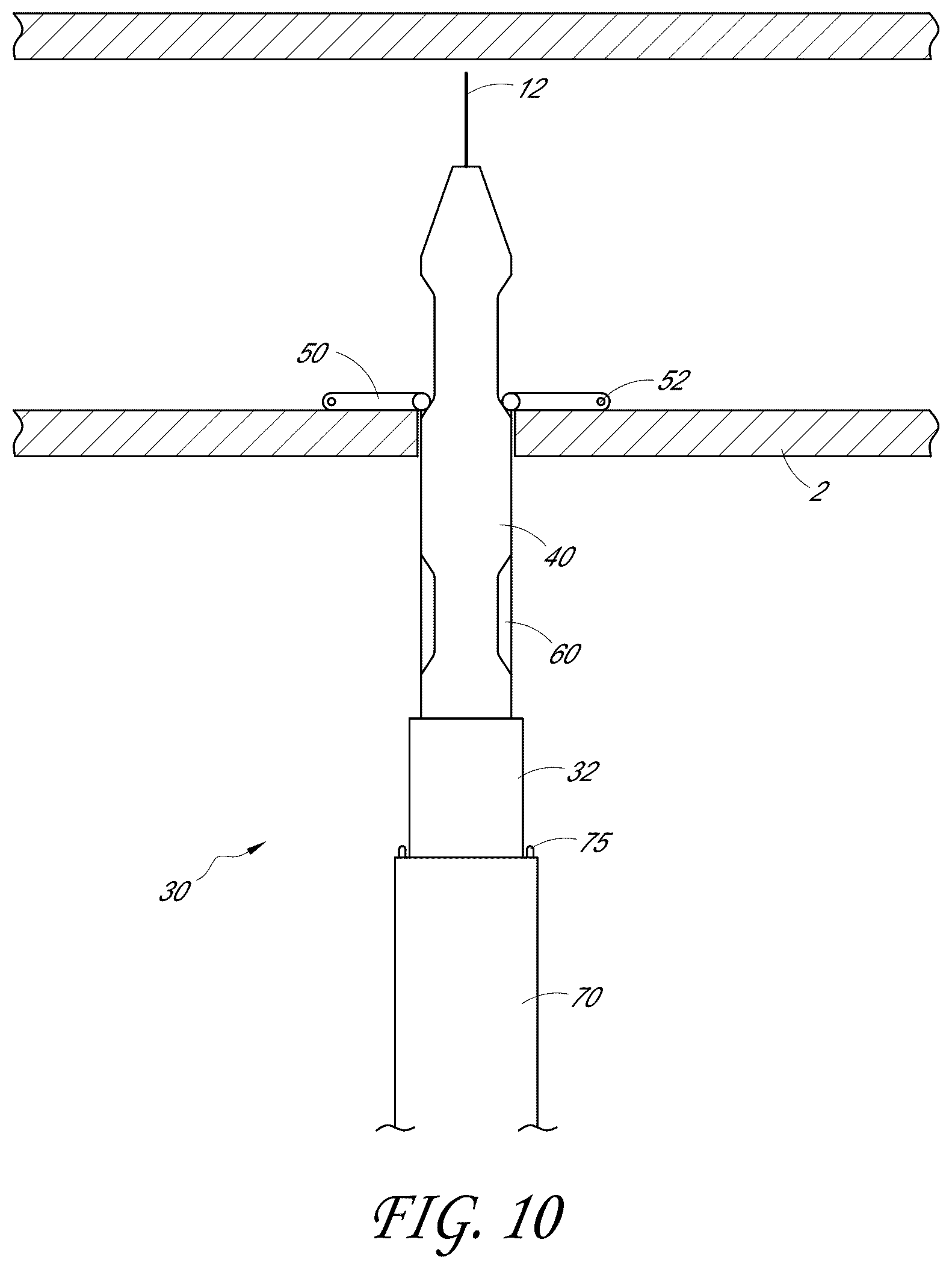 Patent US12376846 Figure 10 – Suturing devices and methods for suturing an anatomic structure