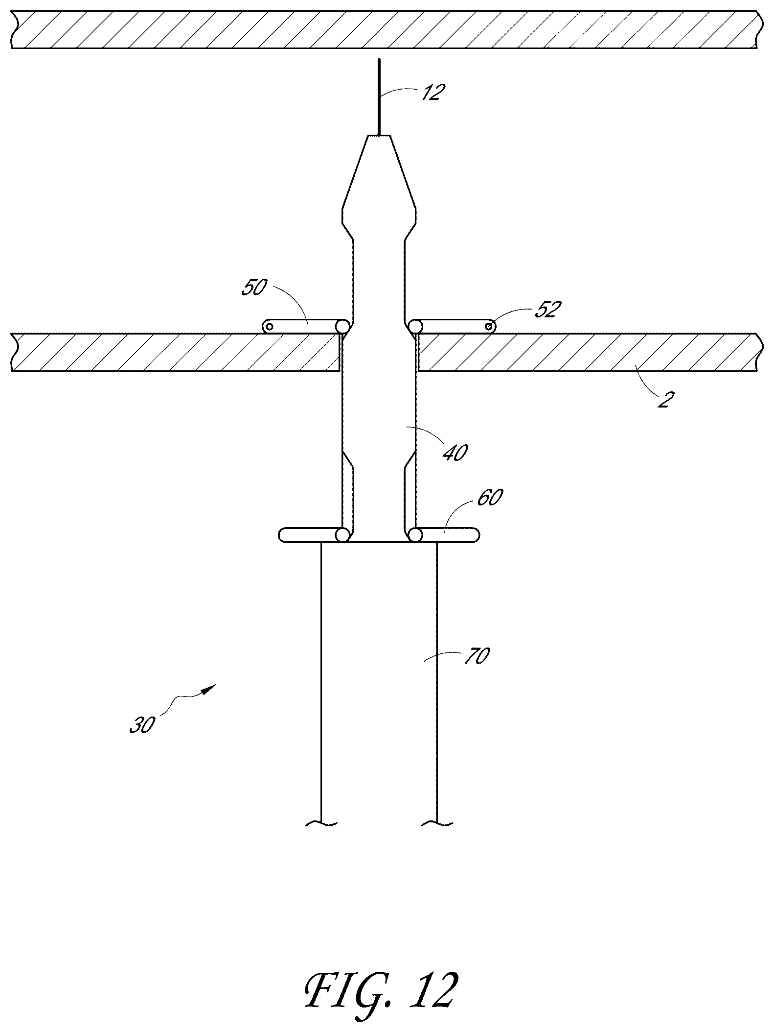 Patent US12376846 Figure 12 – Suturing devices and methods for suturing an anatomic structure