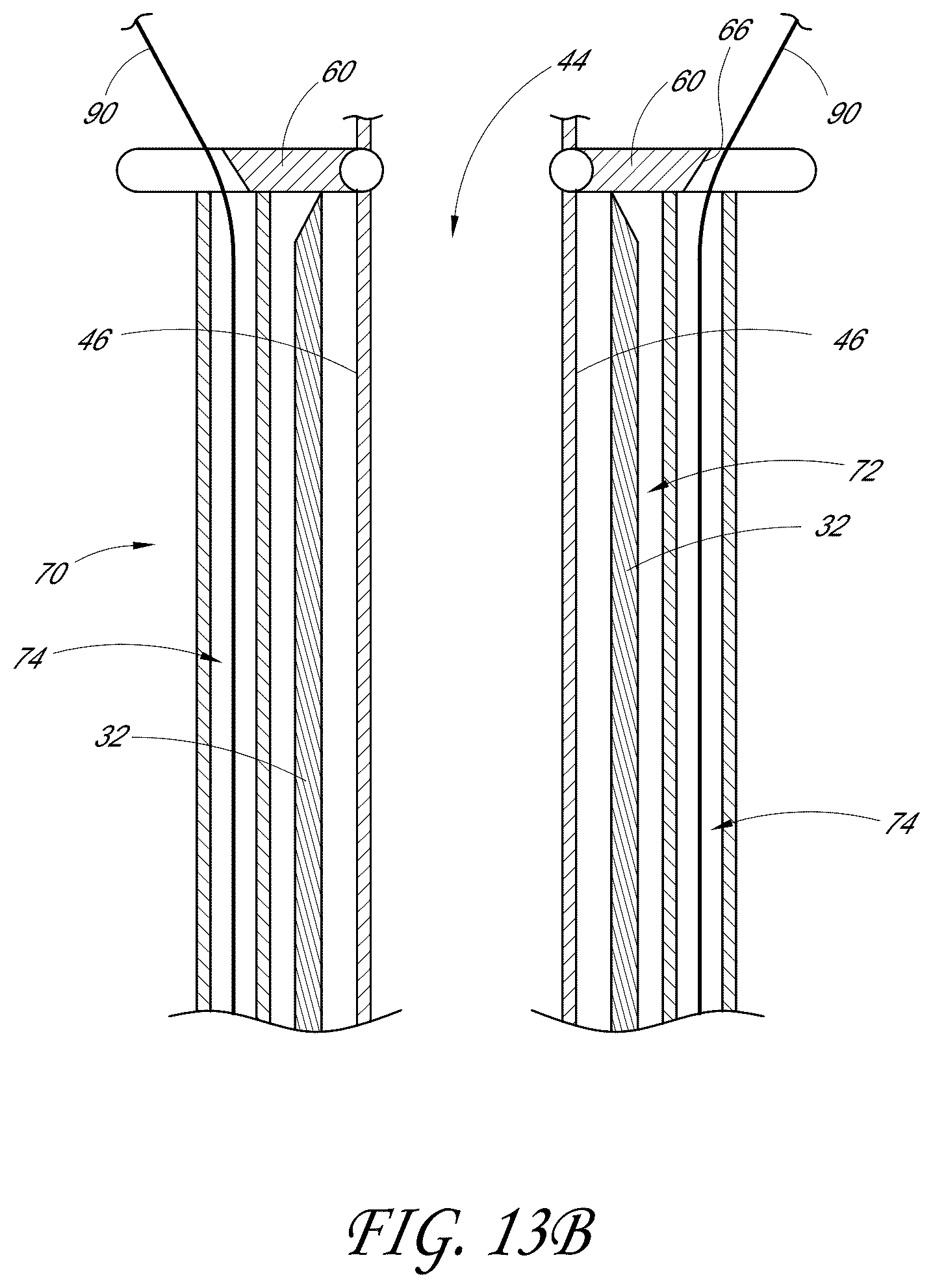 Patent US12376846 Figure 14 – Suturing devices and methods for suturing an anatomic structure