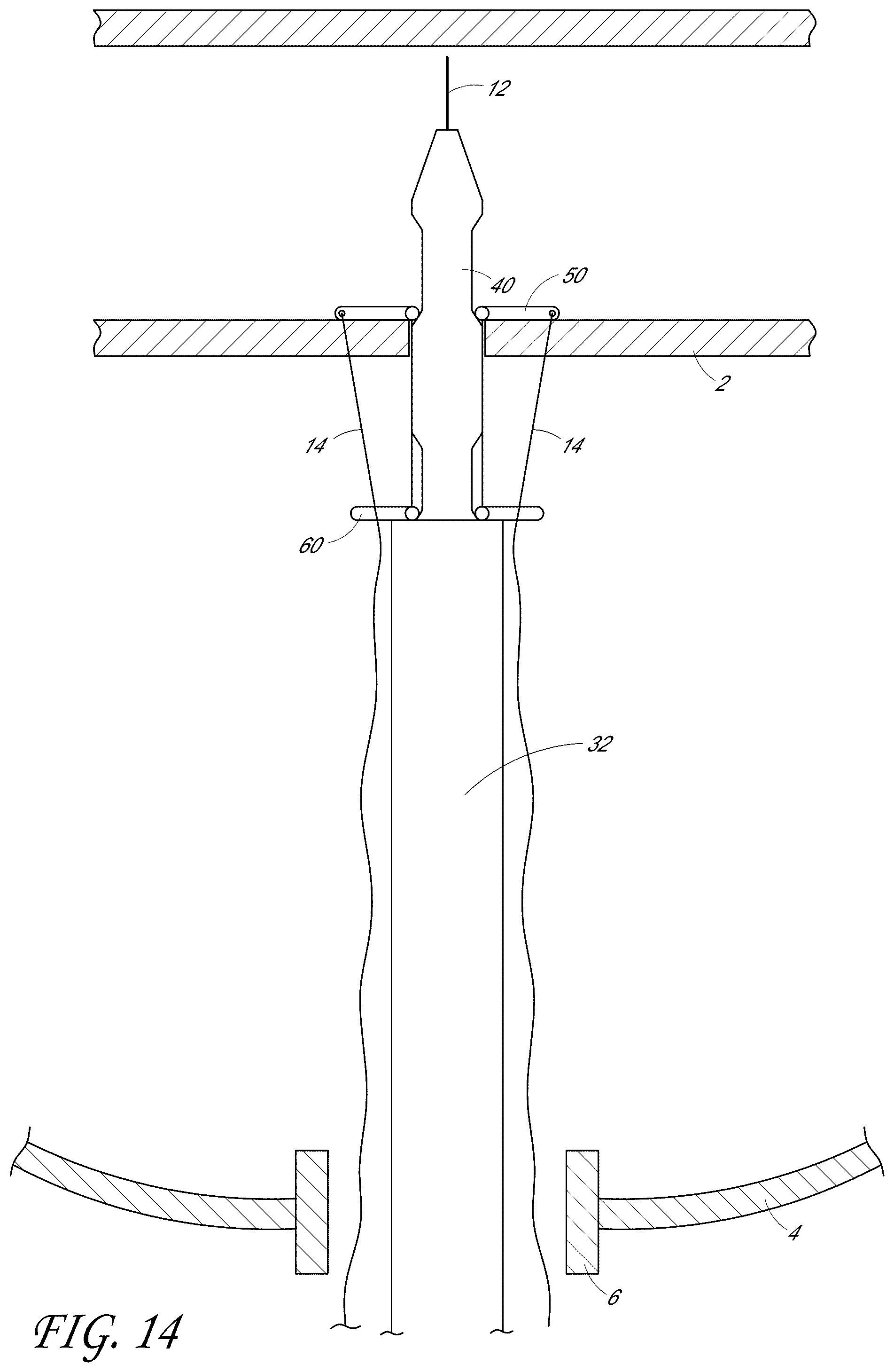 Patent US12376846 Figure 15 – Suturing devices and methods for suturing an anatomic structure