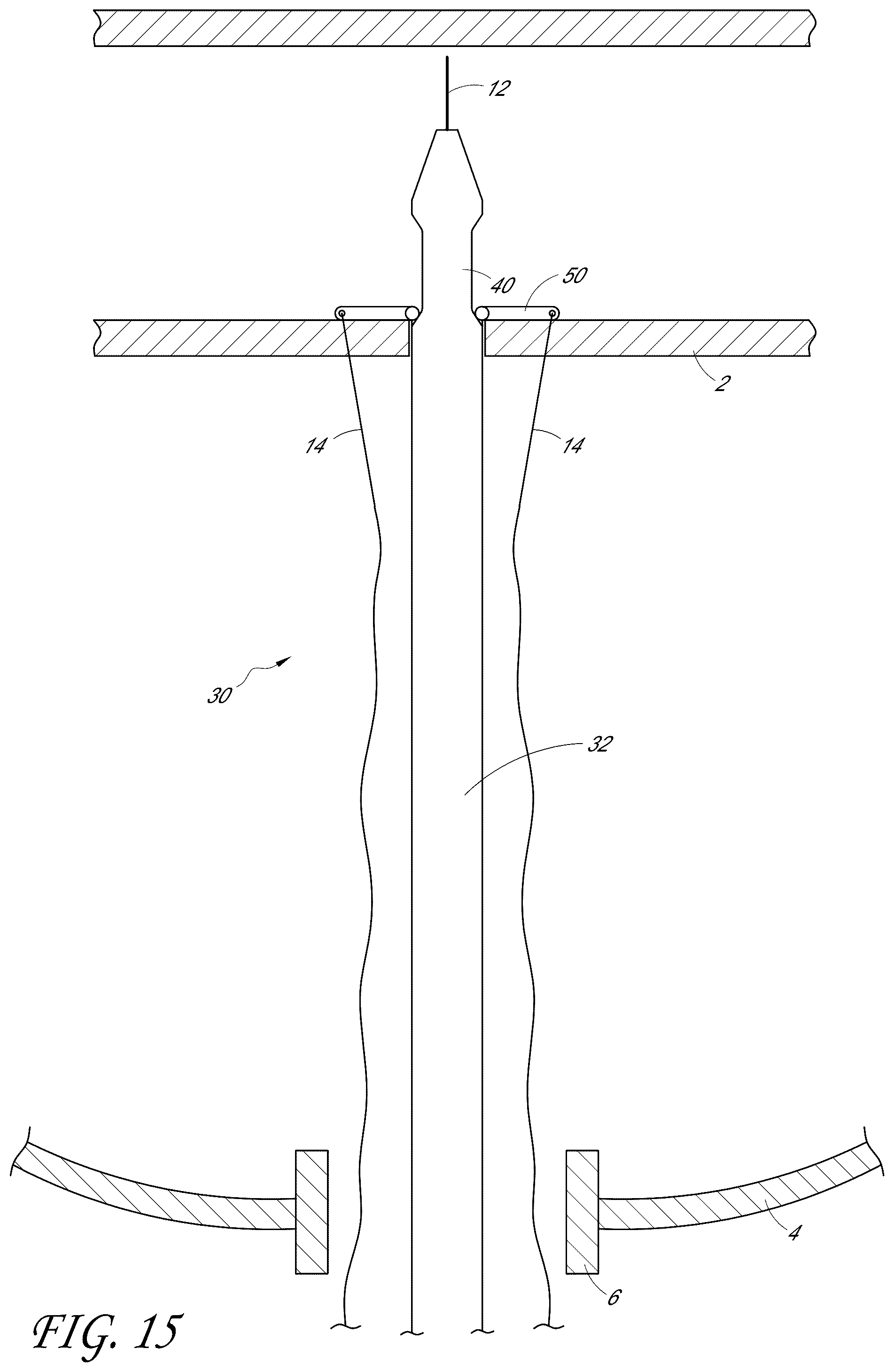 Patent US12376846 Figure 16 – Suturing devices and methods for suturing an anatomic structure