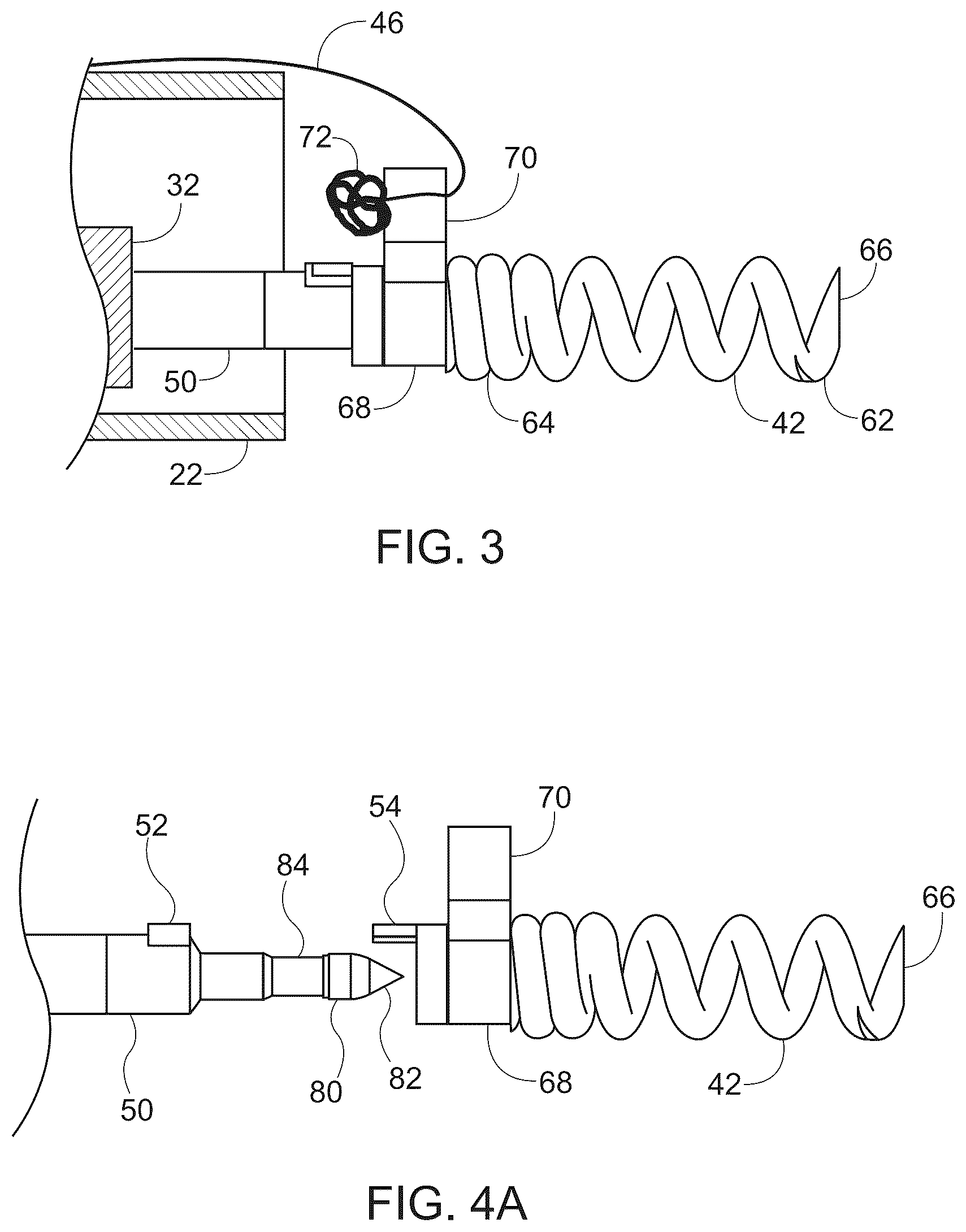Patent US12376847 Figure 2 – Endoscopic tissue approximation system and methods