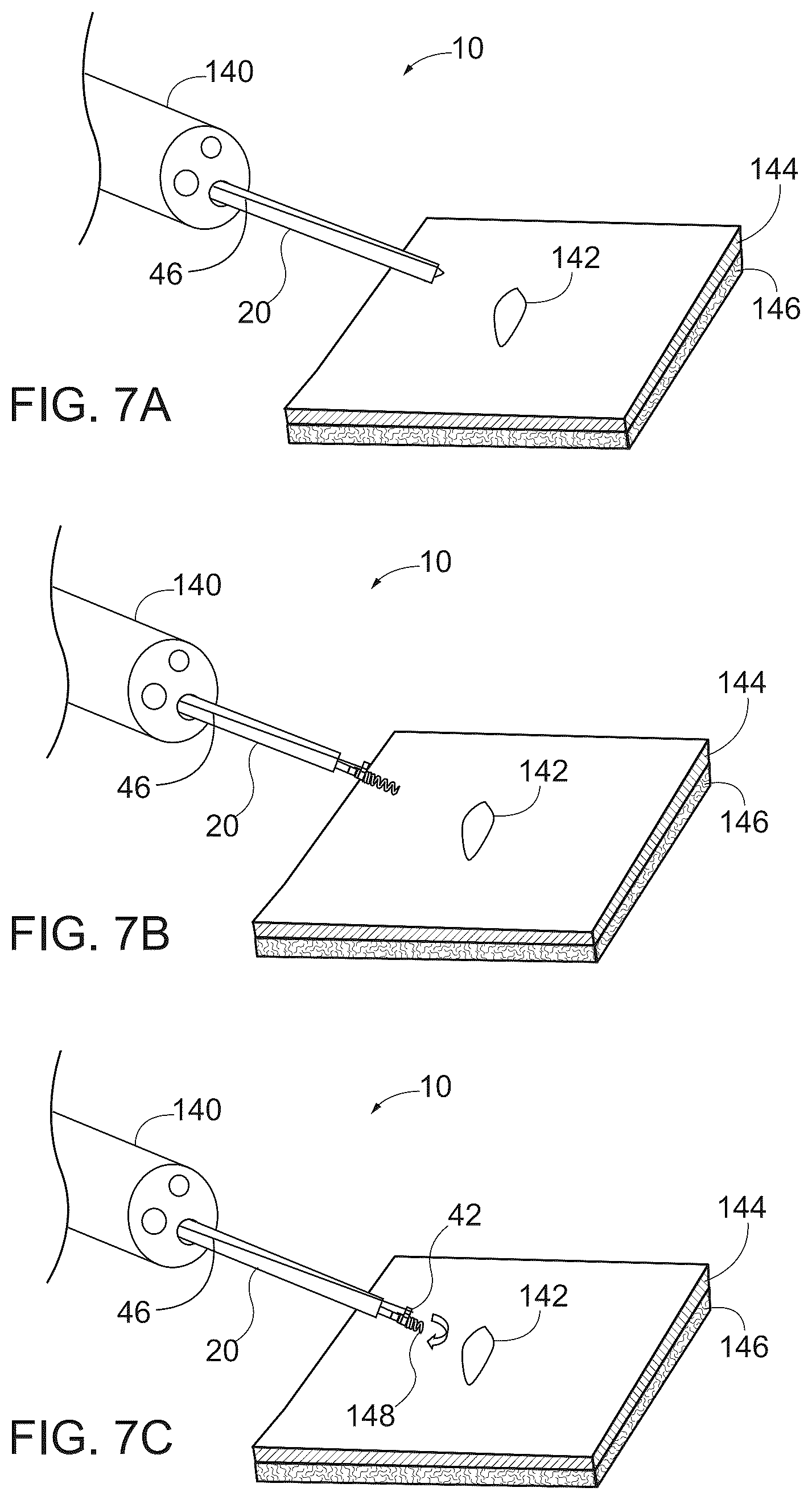 Patent US12376847 Figure 6 – Endoscopic tissue approximation system and methods