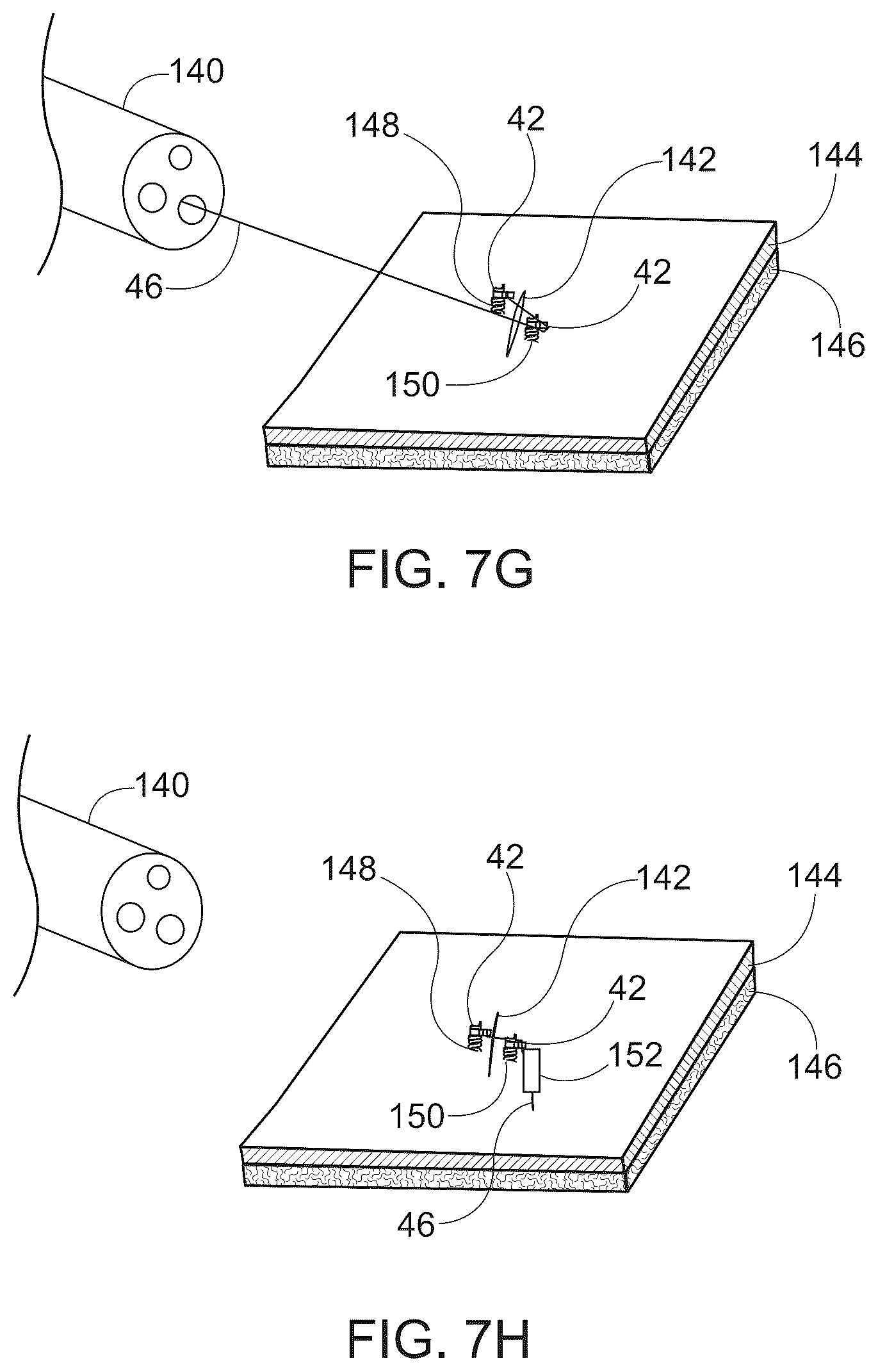 Patent US12376847 Figure 8 – Endoscopic tissue approximation system and methods