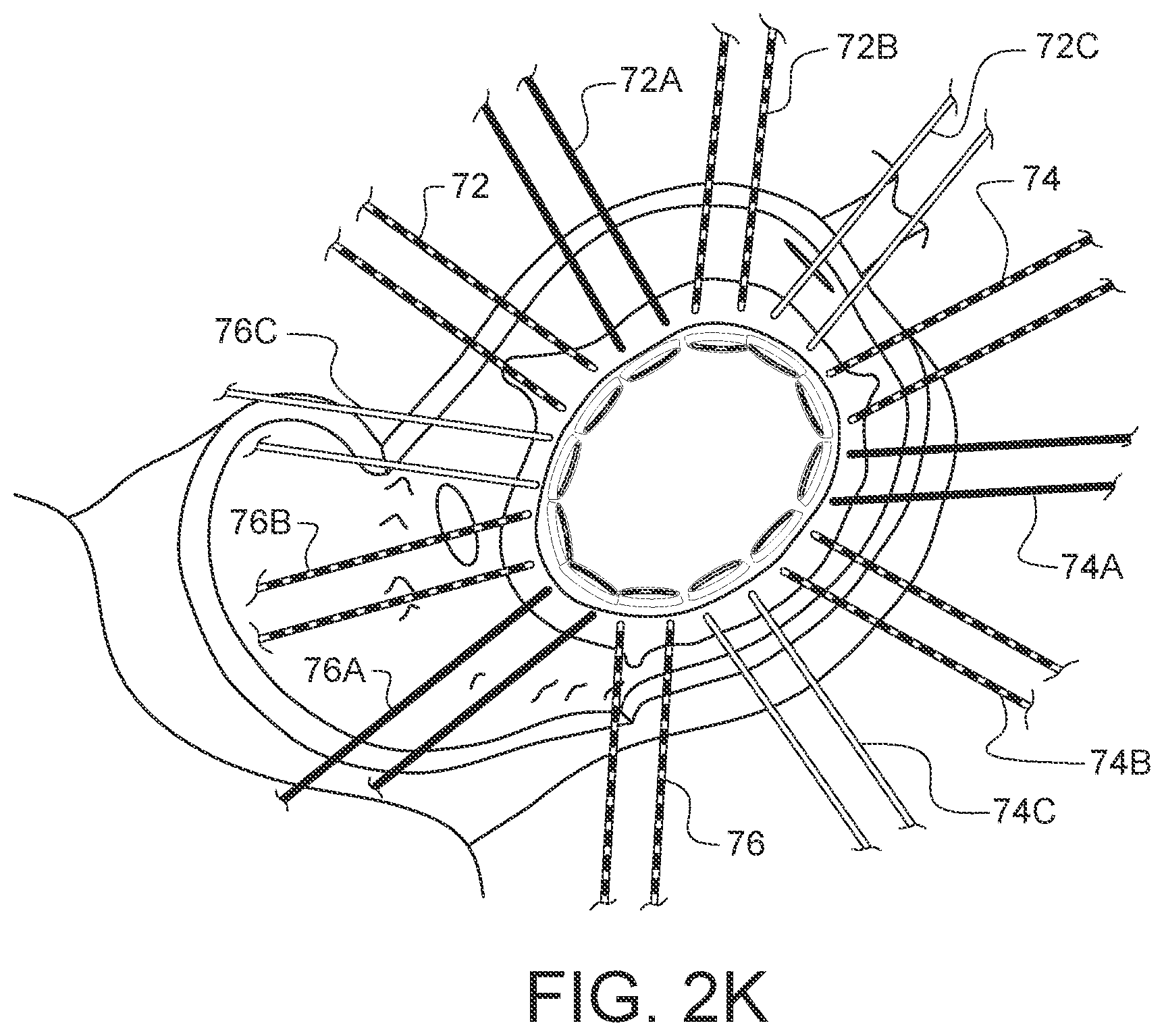 Patent US12376849 Figure 13 – Apparatus for suture management and methods thereof