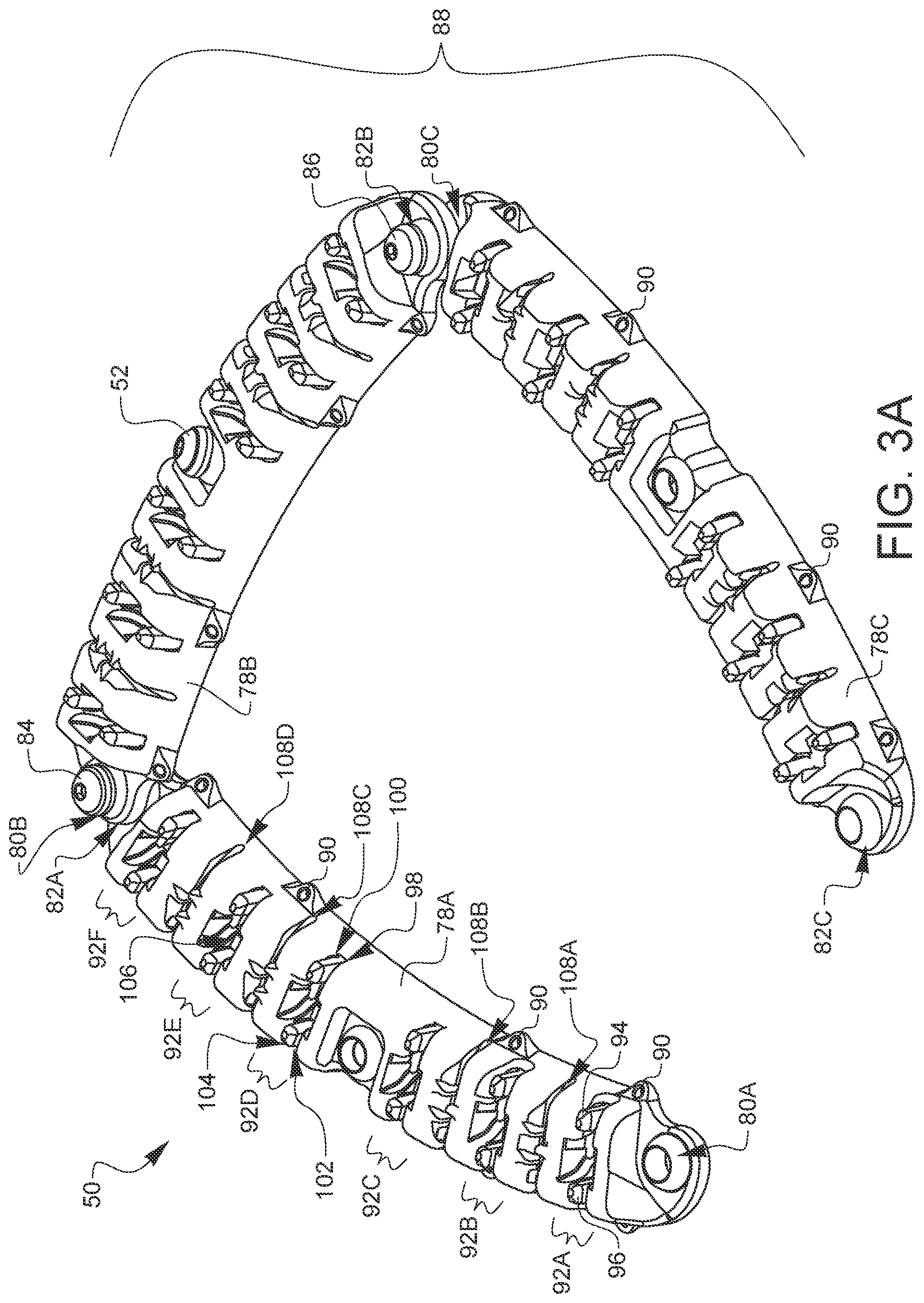 Patent US12376849 Figure 14 – Apparatus for suture management and methods thereof
