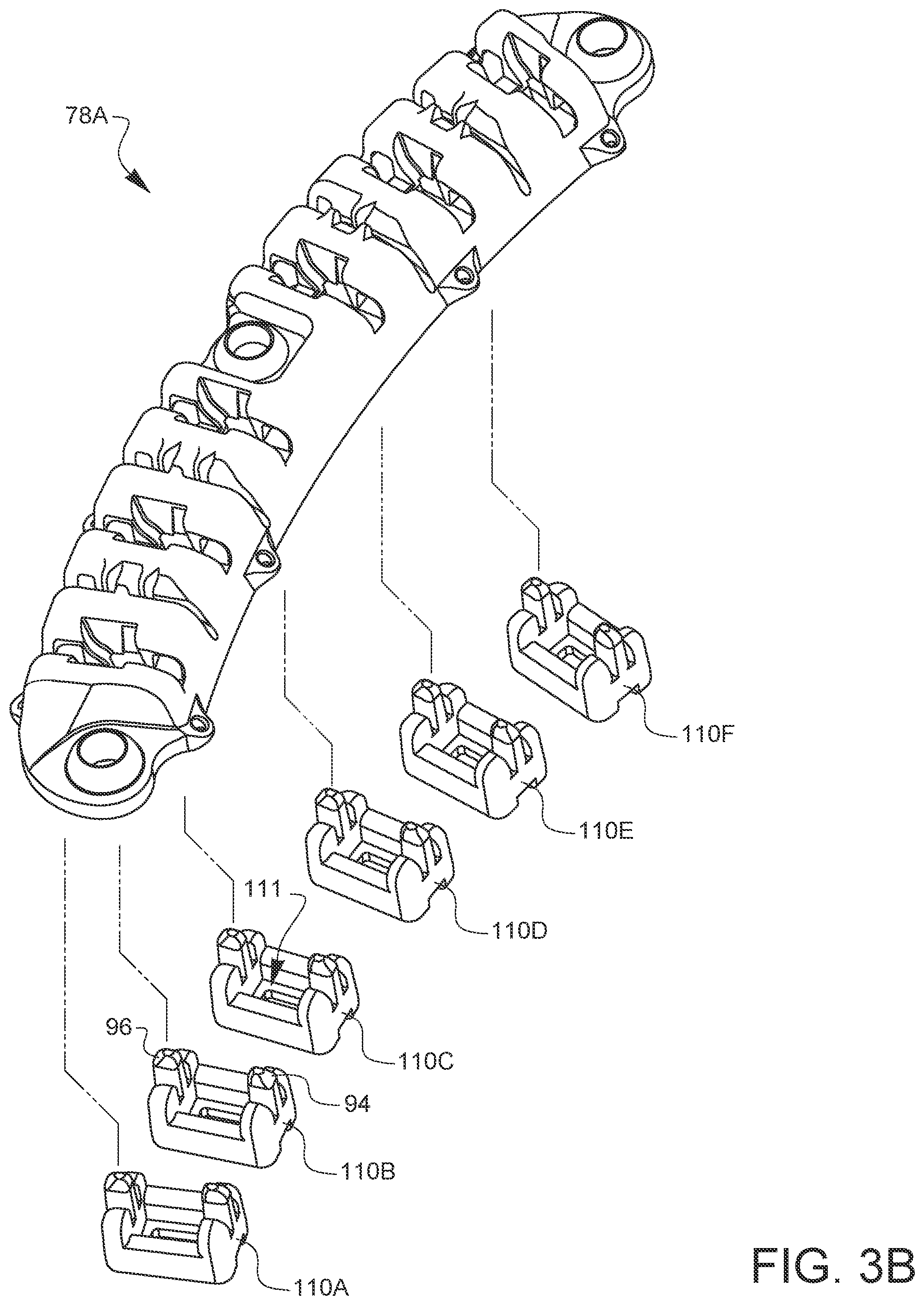 Patent US12376849 Figure 15 – Apparatus for suture management and methods thereof