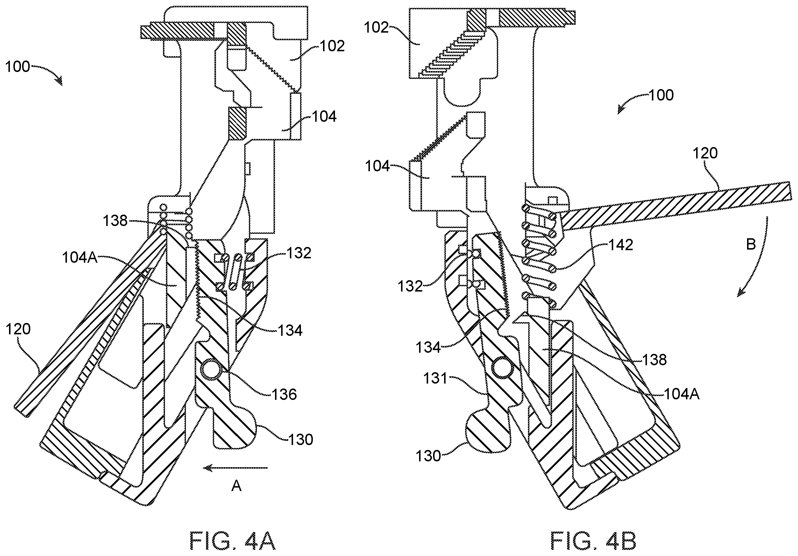 Patent US12376852 Figure 4 – Wound creation for excess skin removal and closure systems and methods