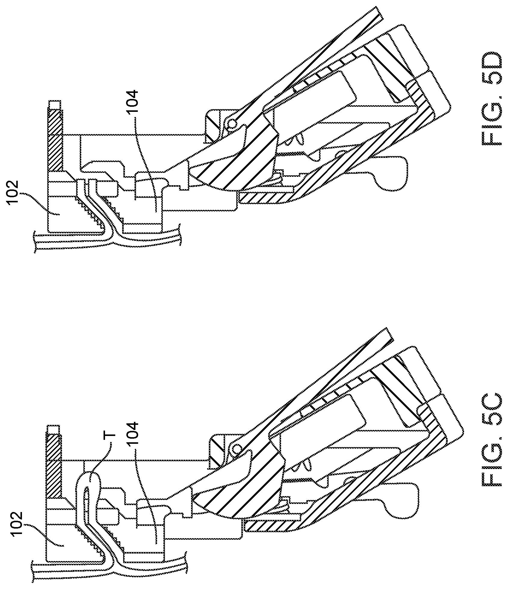 Patent US12376852 Figure 6 – Wound creation for excess skin removal and closure systems and methods
