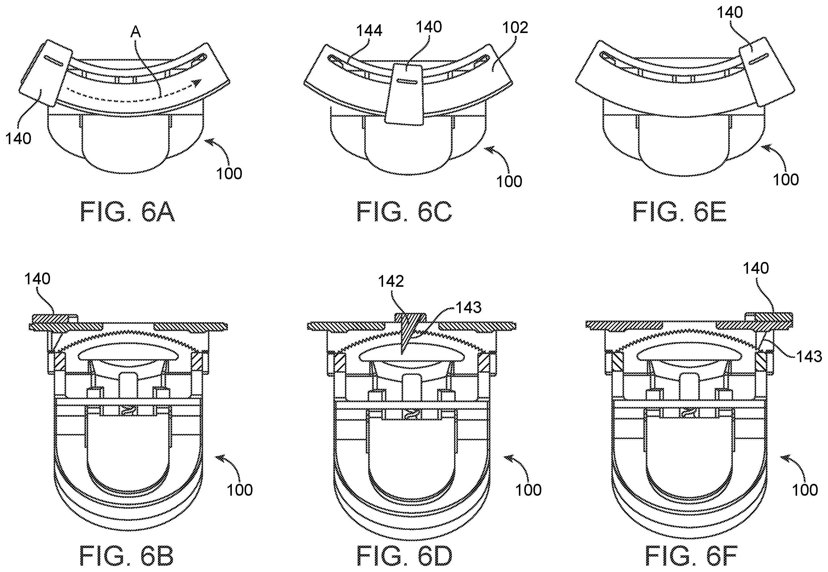 Patent US12376852 Figure 7 – Wound creation for excess skin removal and closure systems and methods