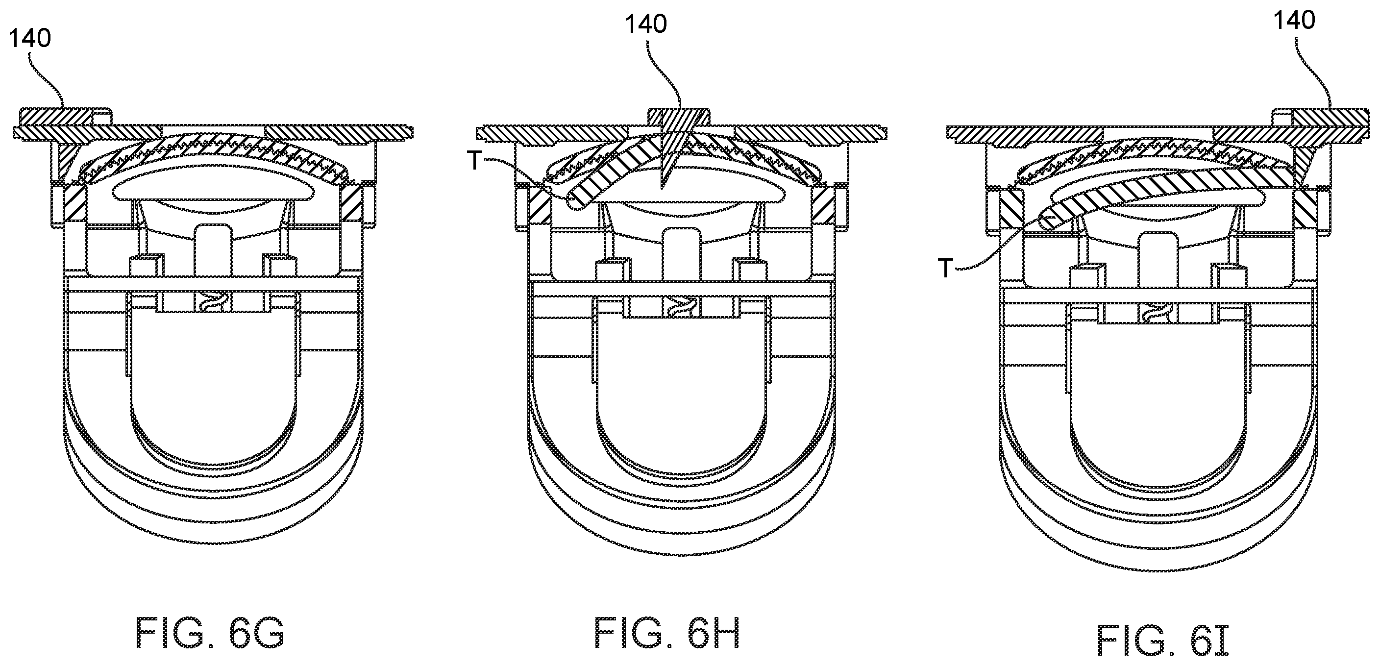 Patent US12376852 Figure 8 – Wound creation for excess skin removal and closure systems and methods