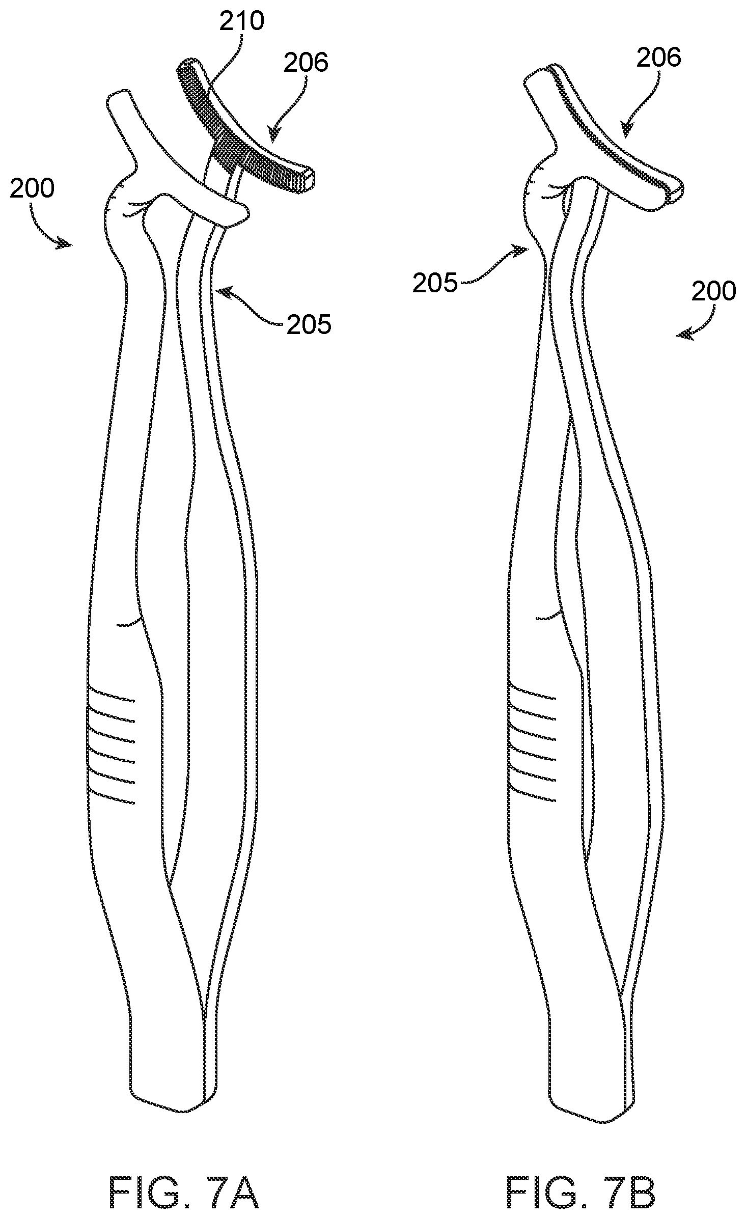 Patent US12376852 Figure 9 – Wound creation for excess skin removal and closure systems and methods