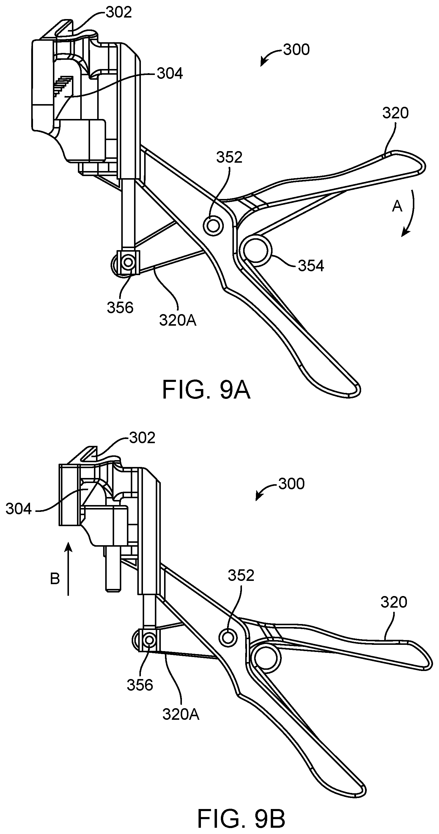 Patent US12376852 Figure 11 – Wound creation for excess skin removal and closure systems and methods