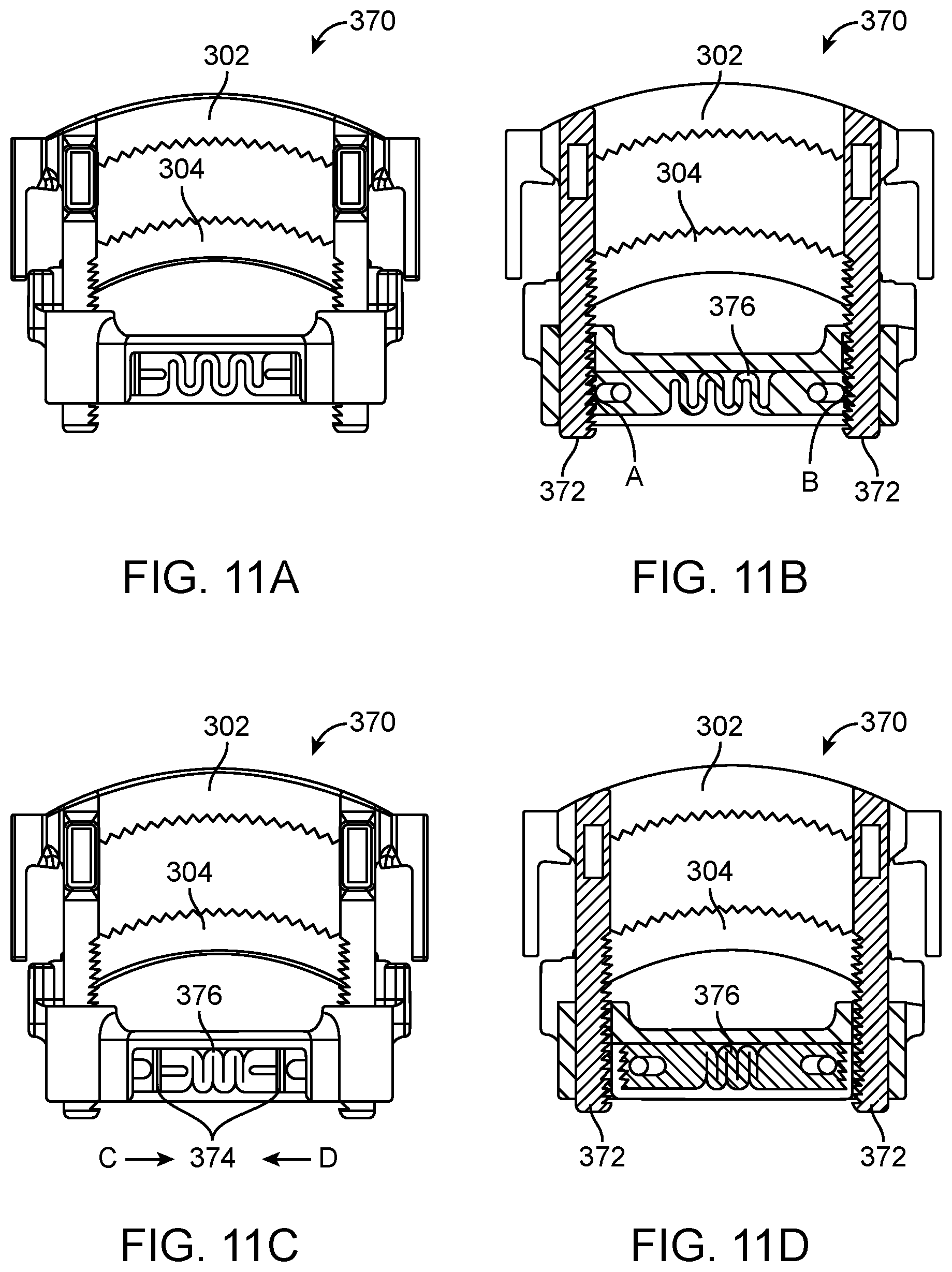 Patent US12376852 Figure 13 – Wound creation for excess skin removal and closure systems and methods