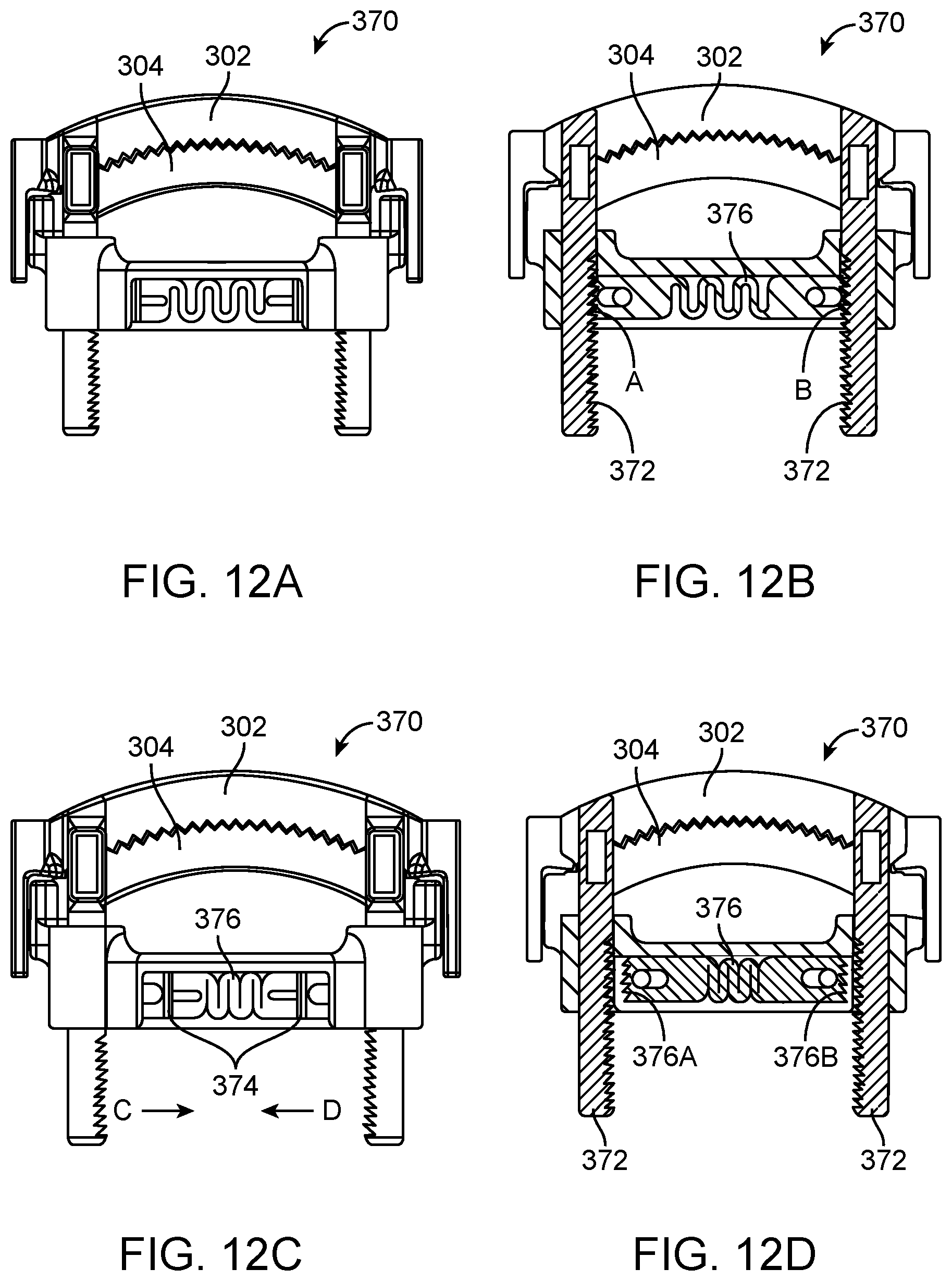 Patent US12376852 Figure 14 – Wound creation for excess skin removal and closure systems and methods