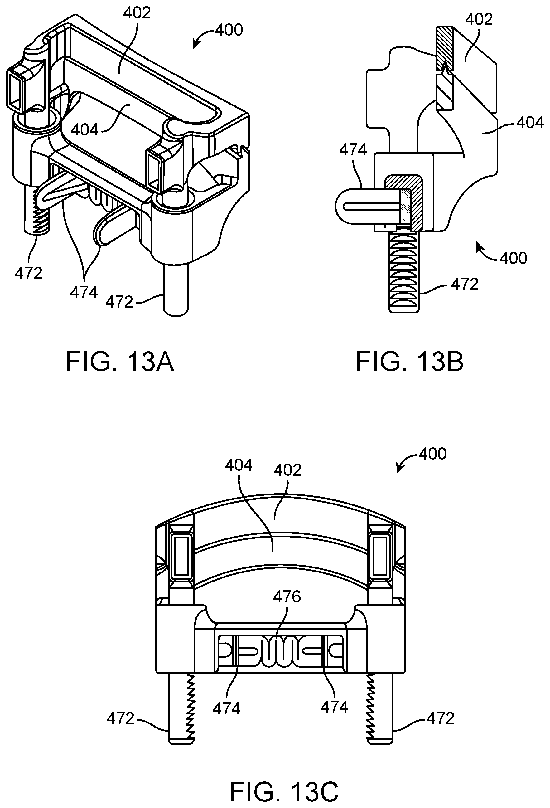 Patent US12376852 Figure 16 – Wound creation for excess skin removal and closure systems and methods