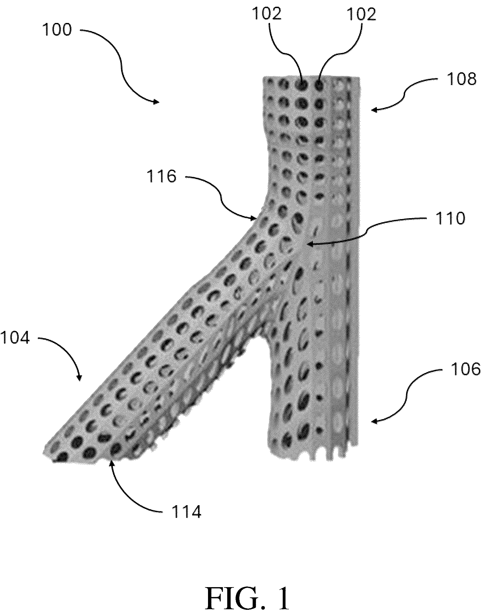 Patent US12376856 Figure 1 – Synthetic perivascular wrap