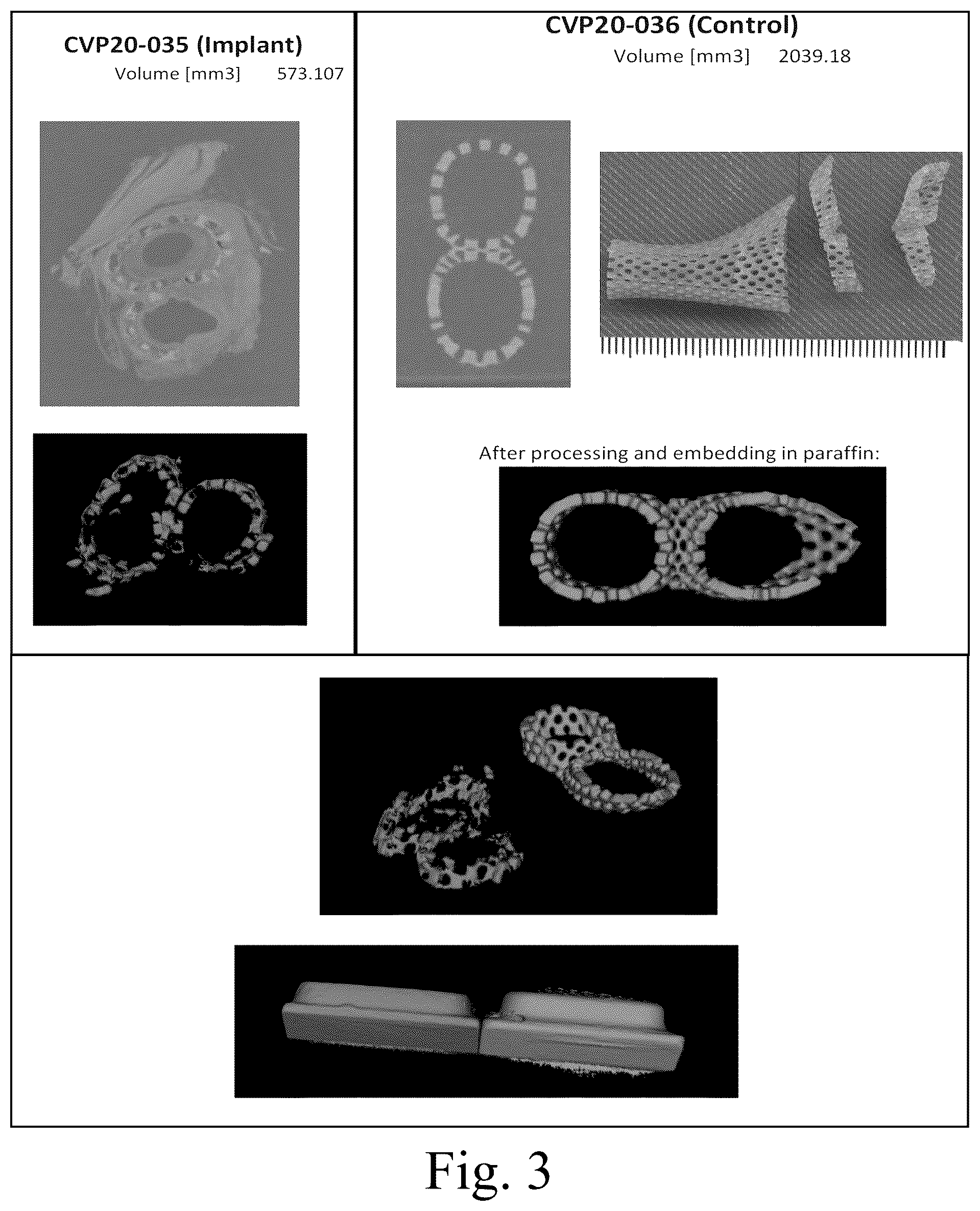 Patent US12376856 Figure 3 – Synthetic perivascular wrap