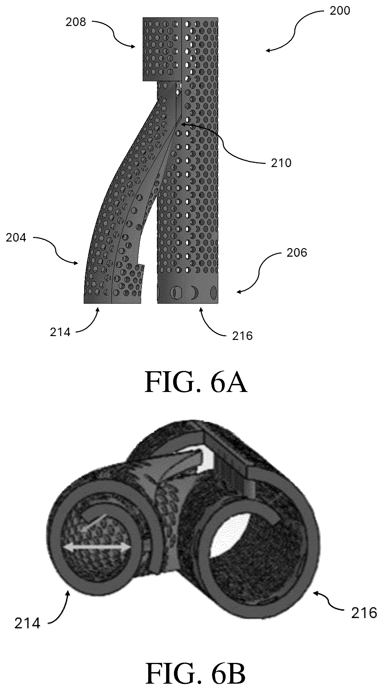 Patent US12376856 Figure 6 – Synthetic perivascular wrap