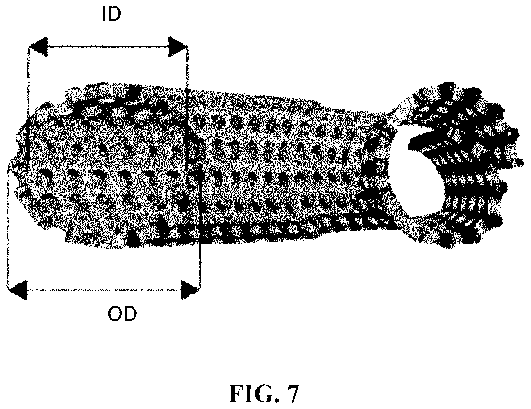 Patent US12376856 Figure 7 – Synthetic perivascular wrap
