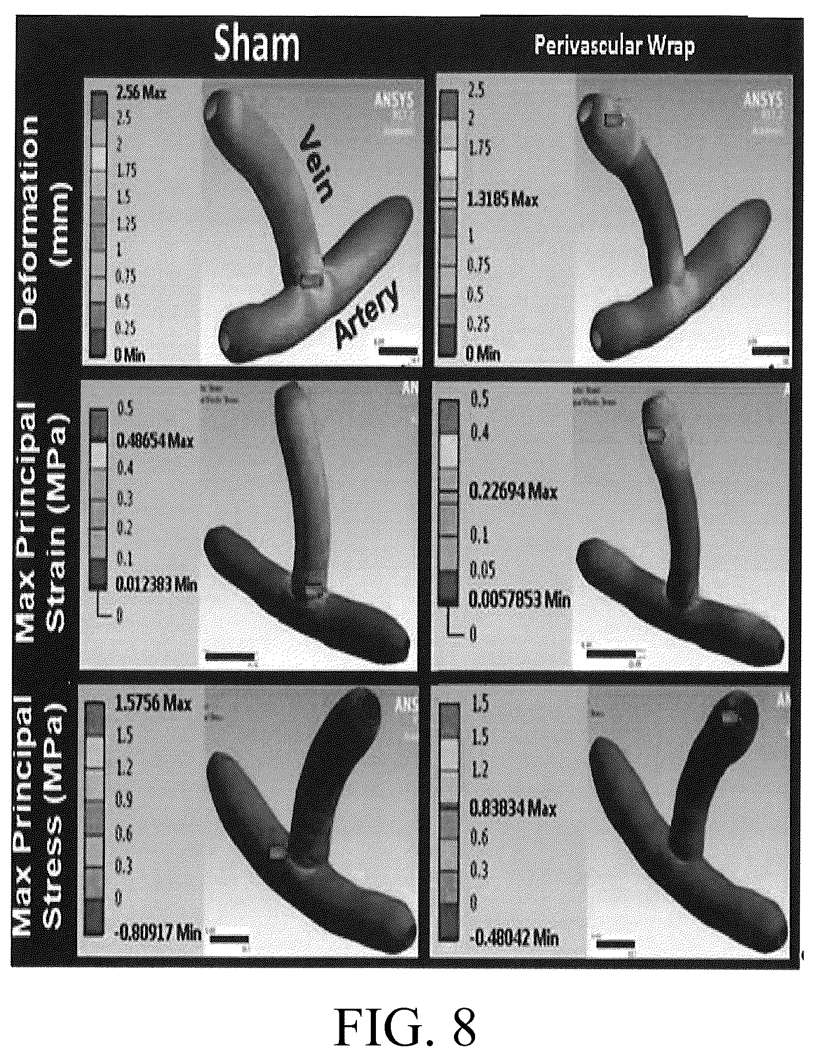 Patent US12376856 Figure 8 – Synthetic perivascular wrap