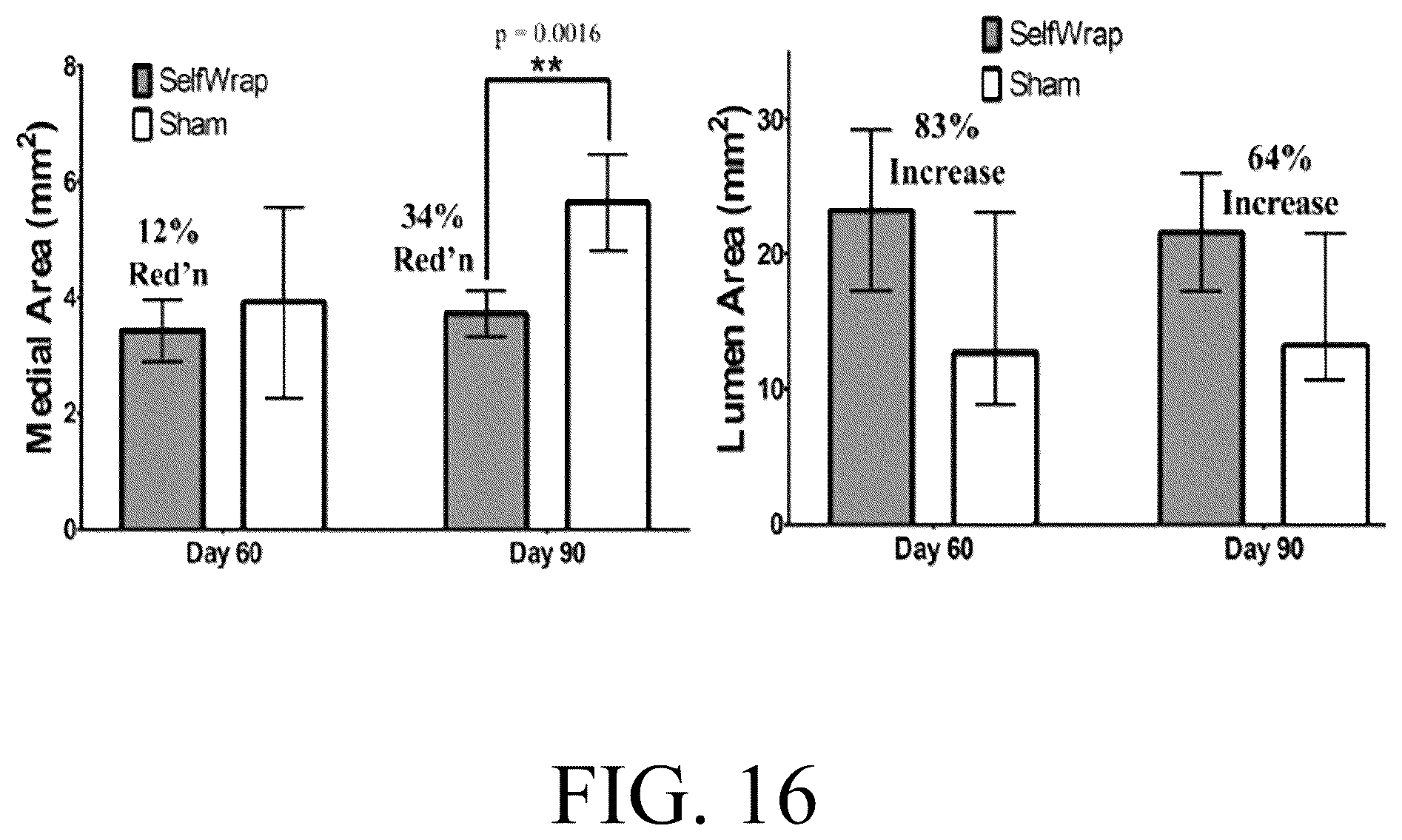 Patent US12376856 Figure 16 – Synthetic perivascular wrap