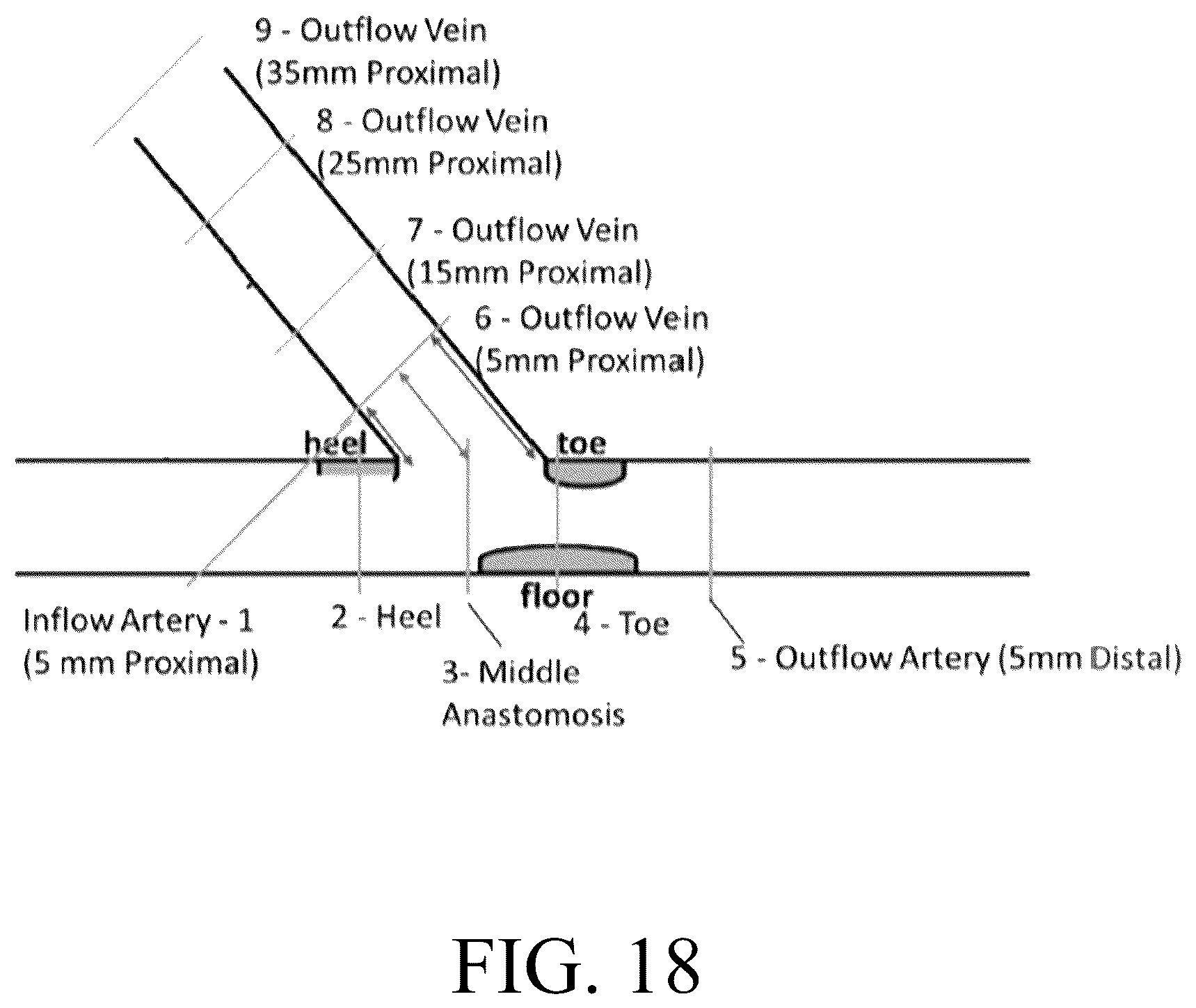 Patent US12376856 Figure 18 – Synthetic perivascular wrap