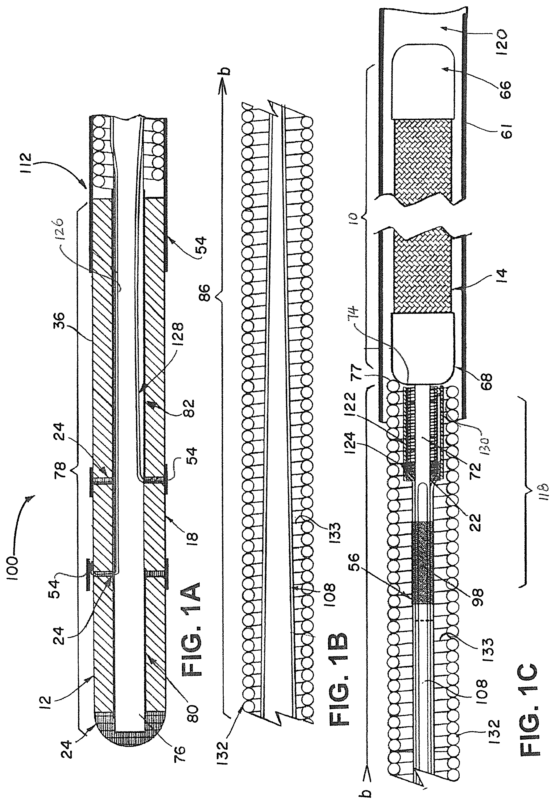 Patent US12376858 Figure 1 – Delivery and detachment systems and methods for vascular implants