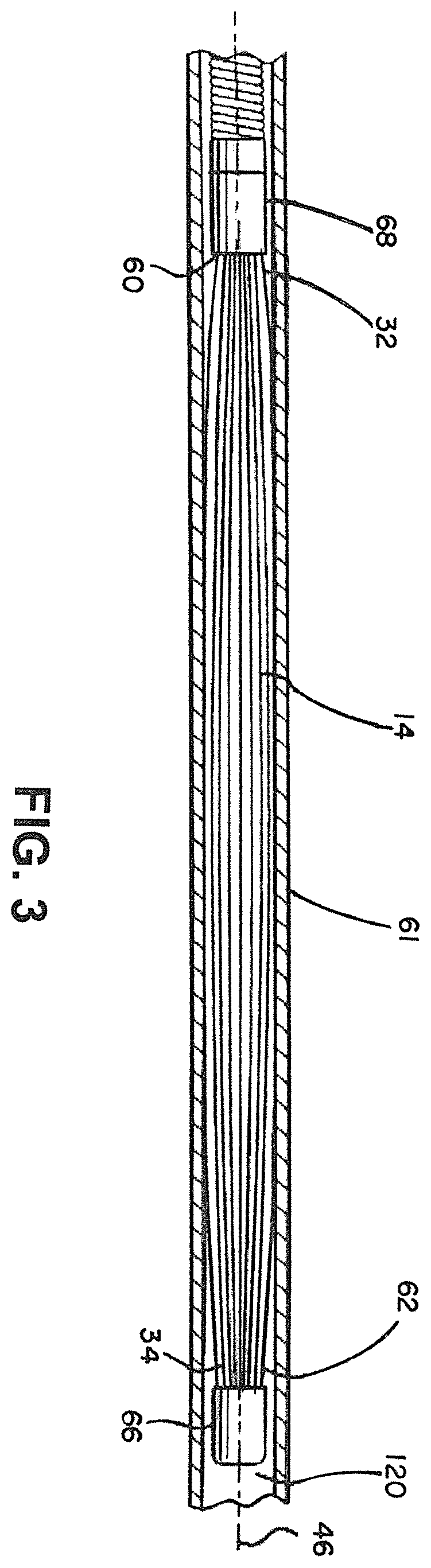 Patent US12376858 Figure 3 – Delivery and detachment systems and methods for vascular implants