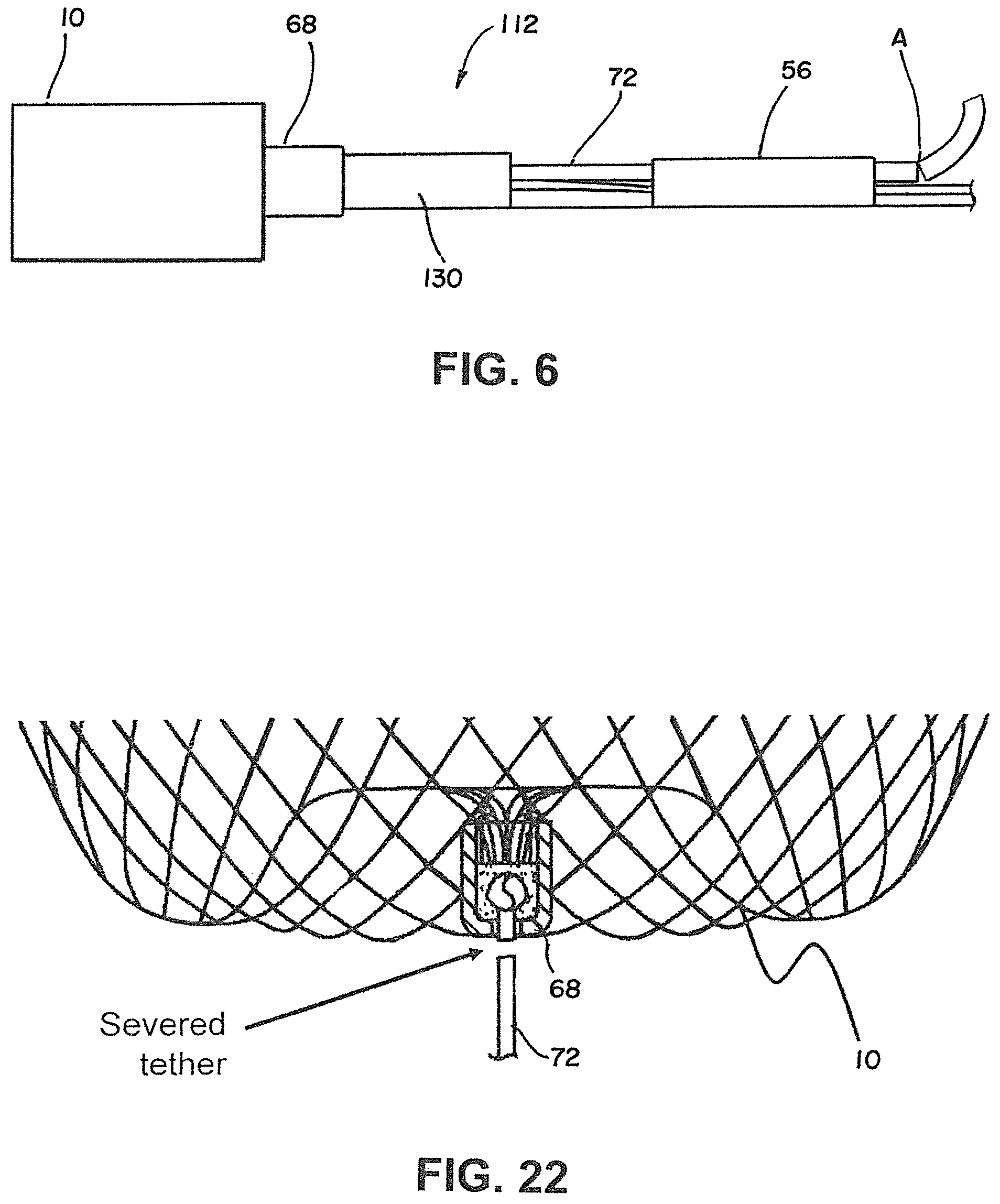 Patent US12376858 Figure 6 – Delivery and detachment systems and methods for vascular implants
