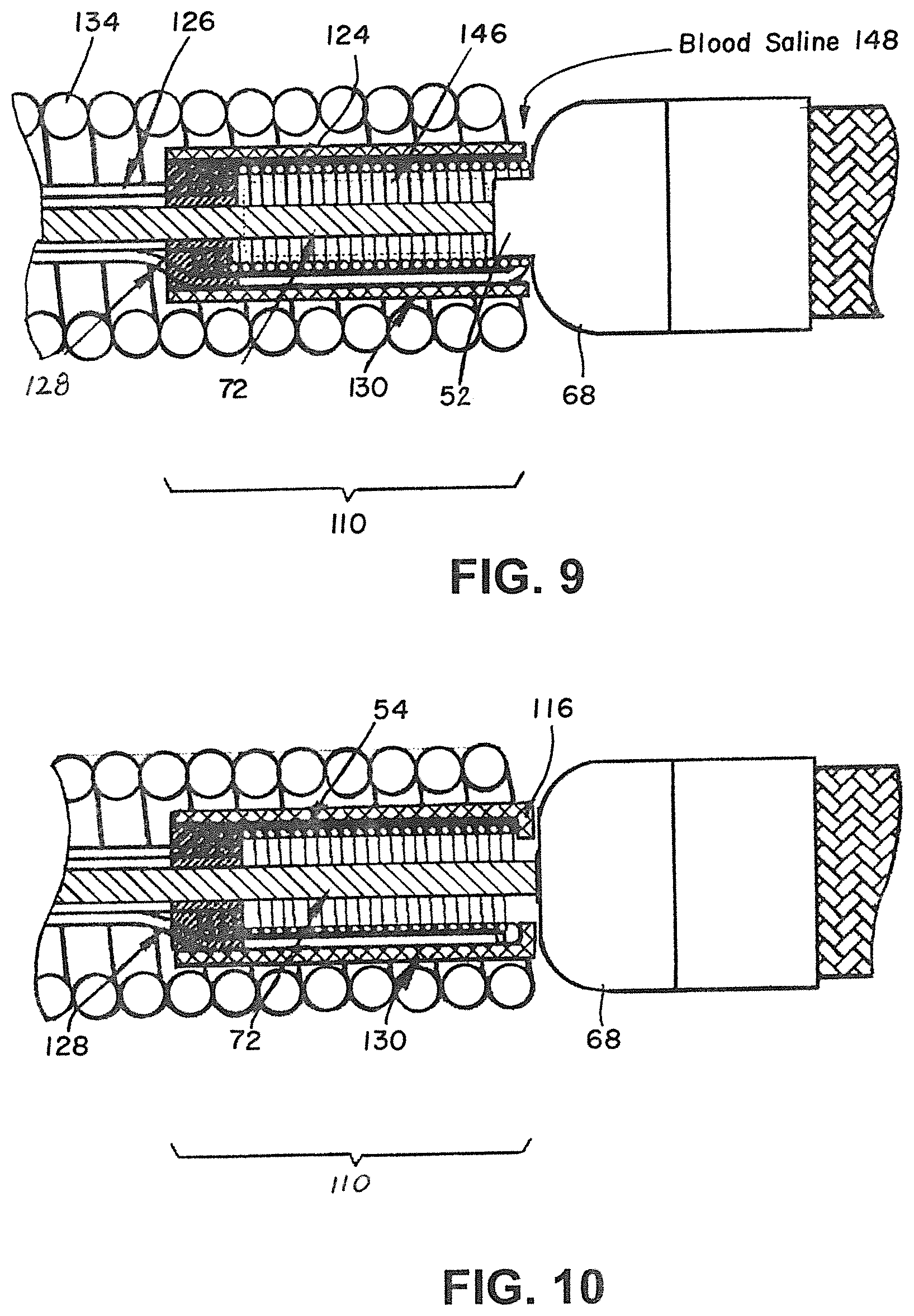 Patent US12376858 Figure 8 – Delivery and detachment systems and methods for vascular implants