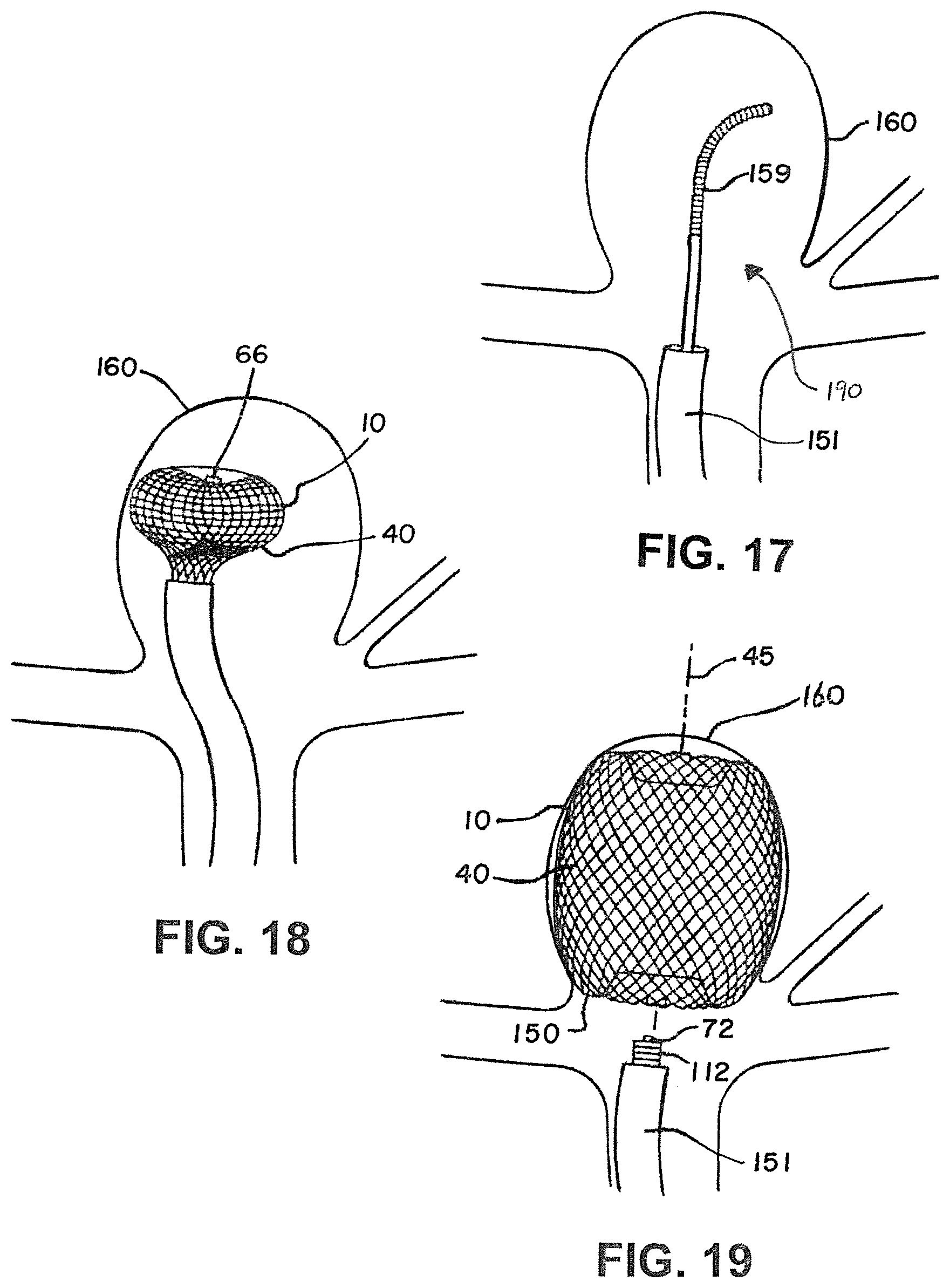 Patent US12376858 Figure 12 – Delivery and detachment systems and methods for vascular implants