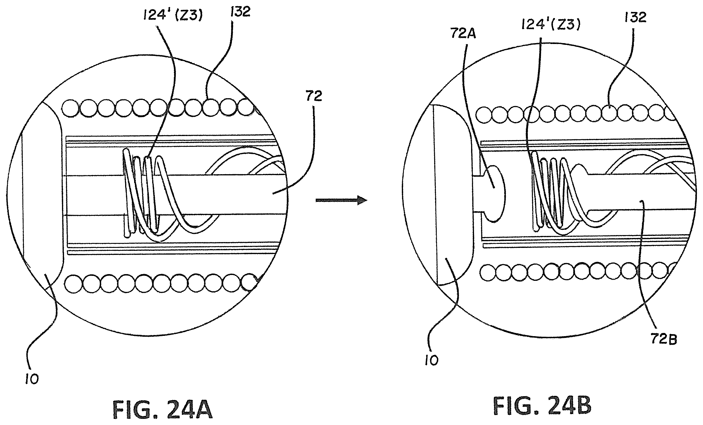 Patent US12376858 Figure 16 – Delivery and detachment systems and methods for vascular implants