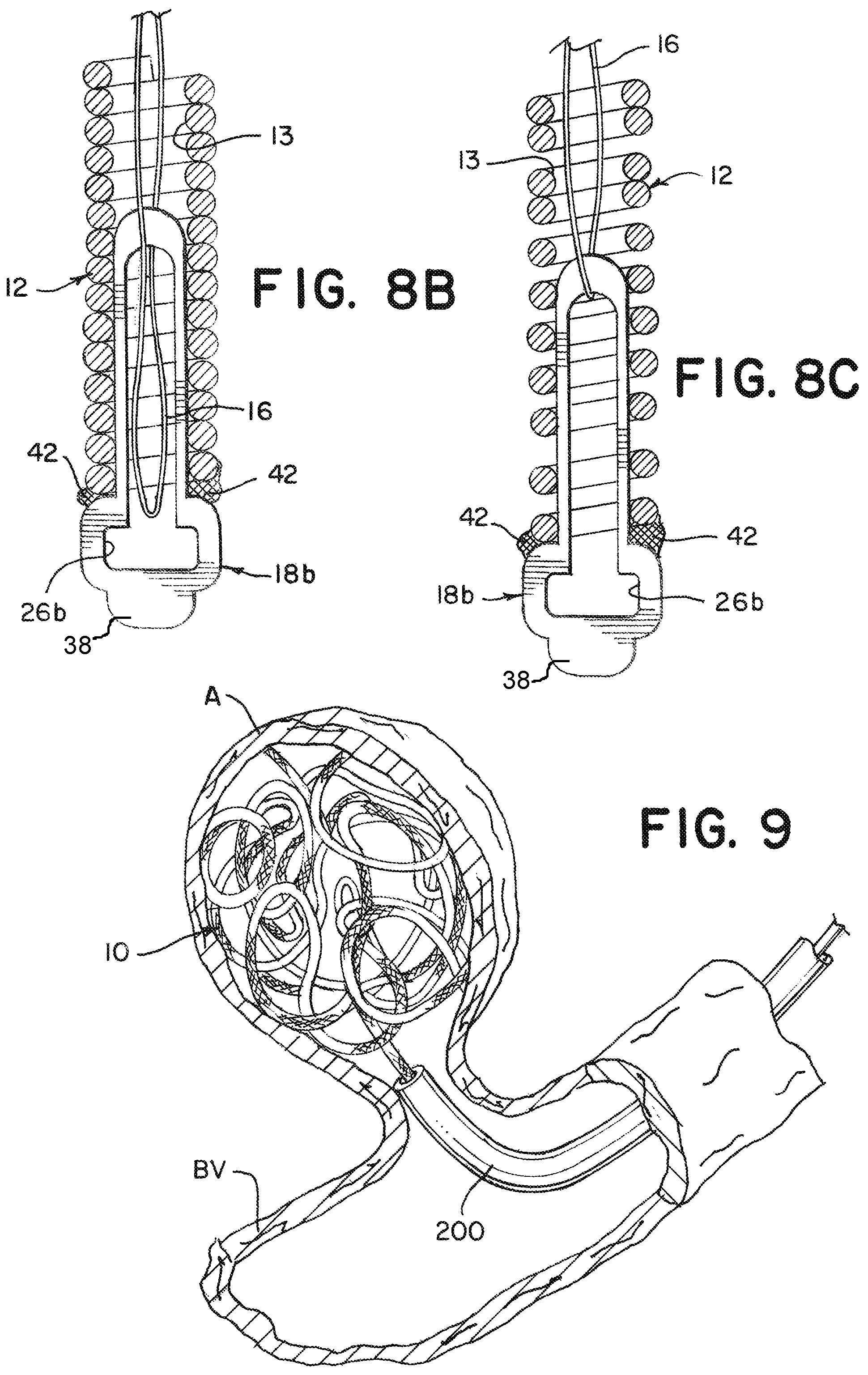 Patent US12376859 Figure 4 – Embolic coil proximal connecting element and stretch resistant fiber