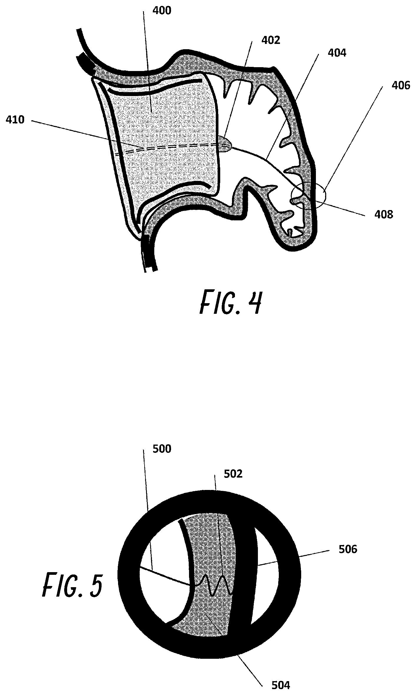 Patent US12376861 Figure 3 – Devices and methods for excluding the left atrial appendage