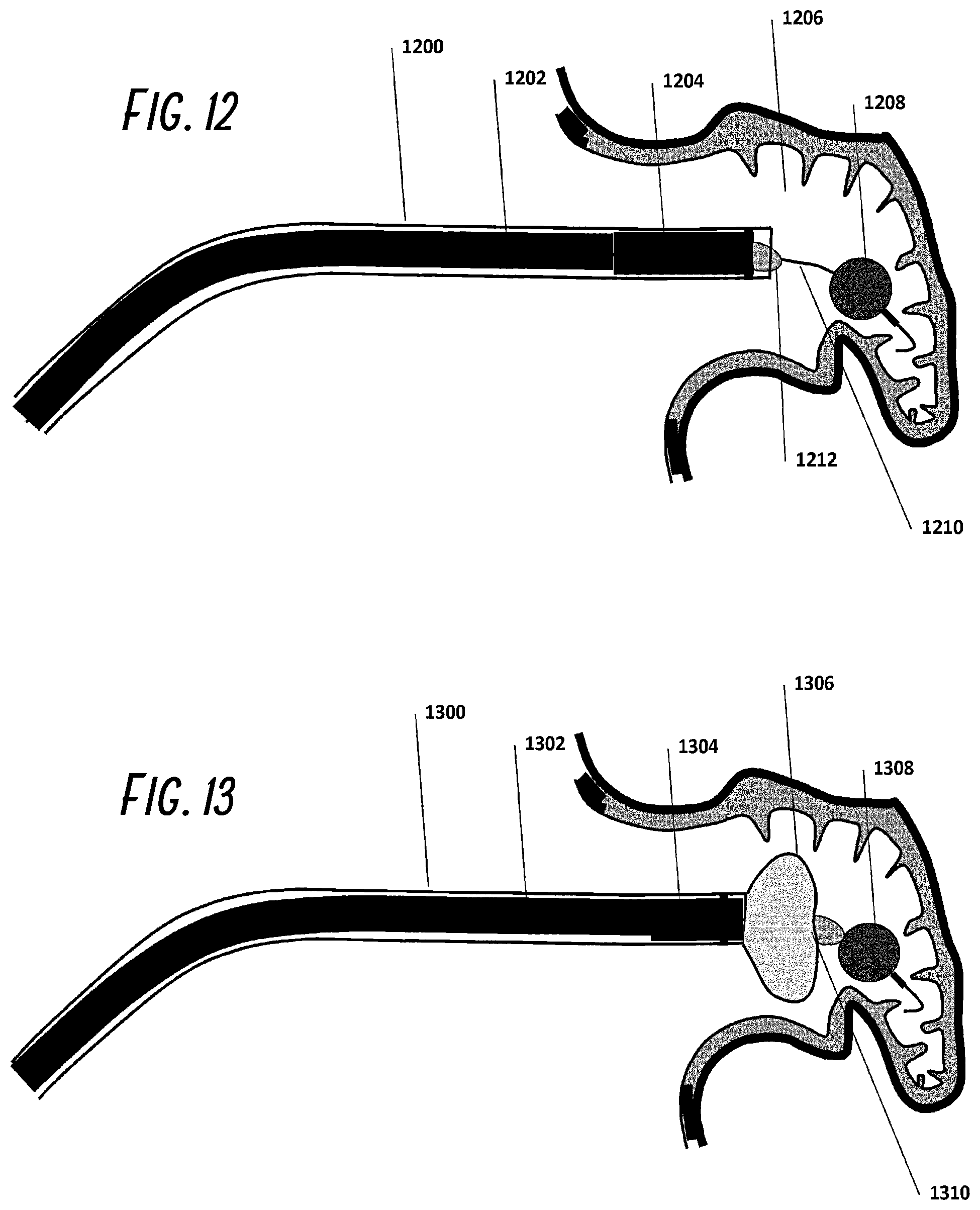 Patent US12376861 Figure 7 – Devices and methods for excluding the left atrial appendage