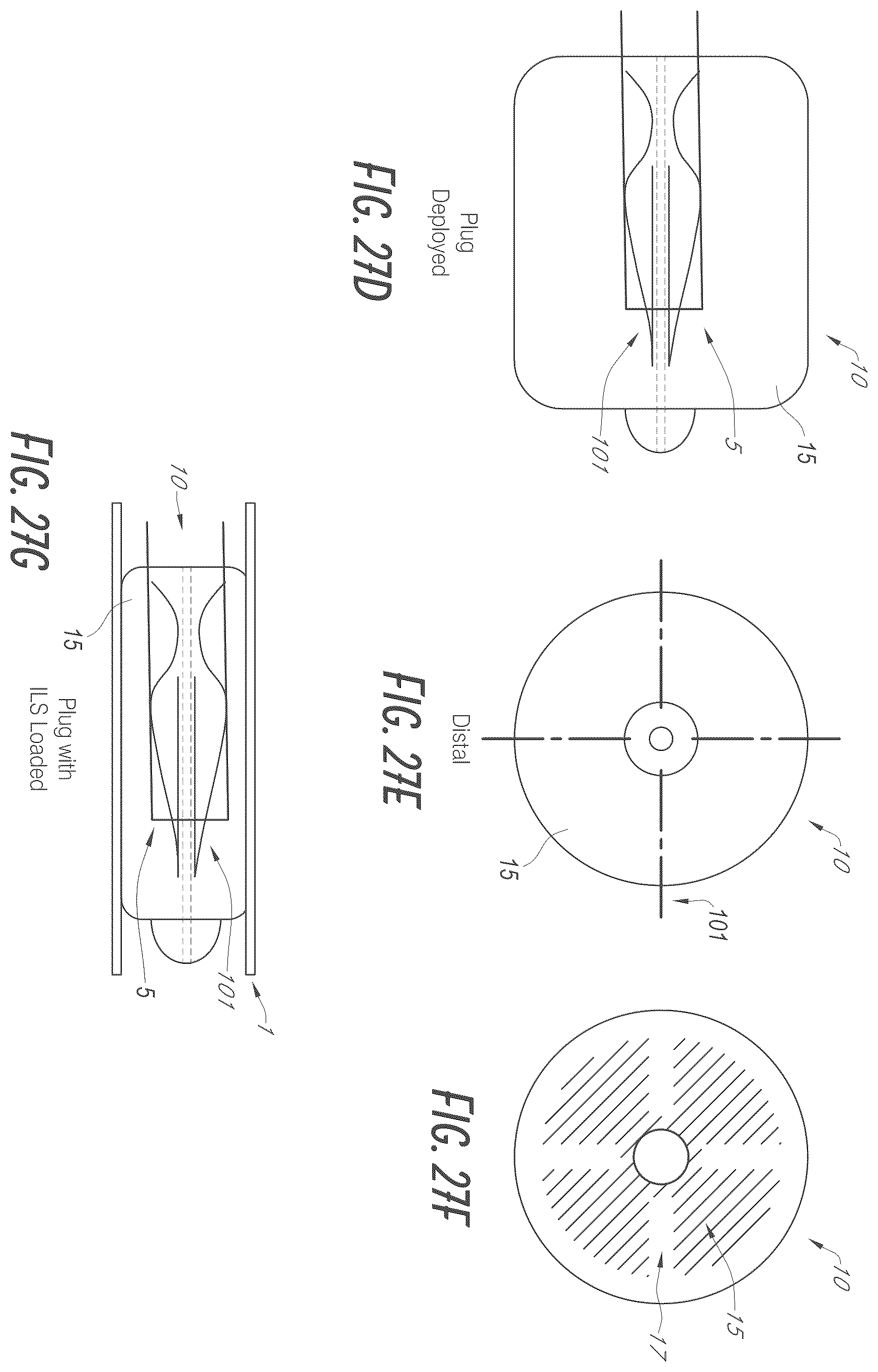 Patent US12376861 Figure 16 – Devices and methods for excluding the left atrial appendage