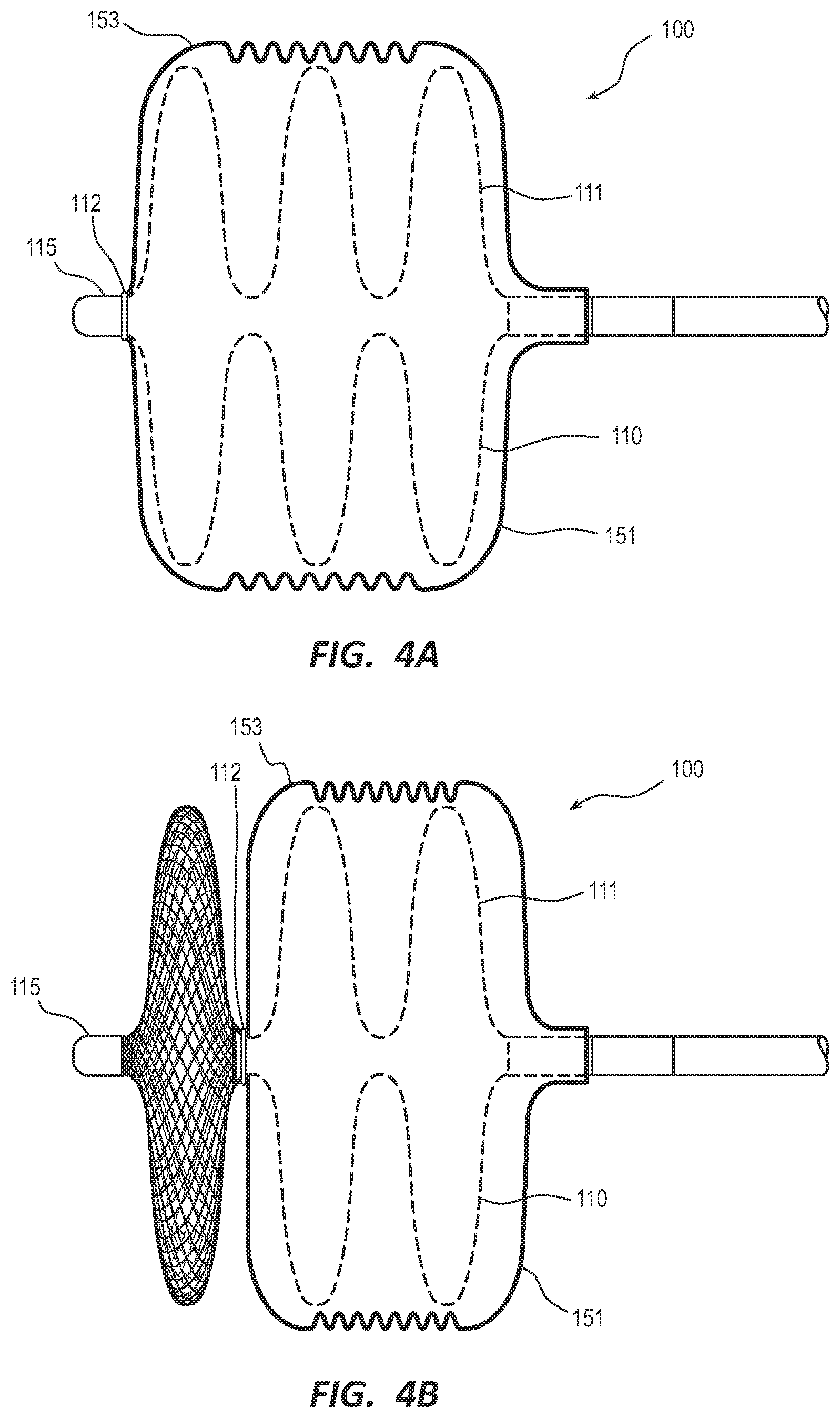 Patent US12376862 Figure 5 – Covered vascular plug