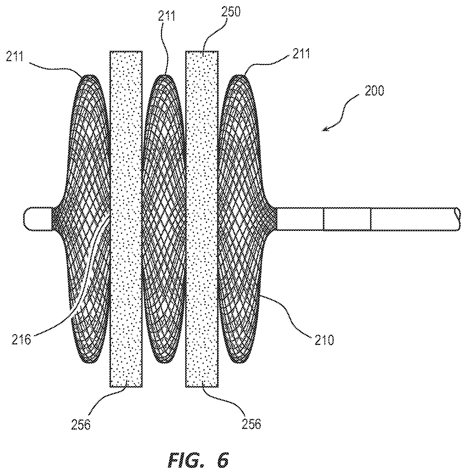 Patent US12376862 Figure 7 – Covered vascular plug
