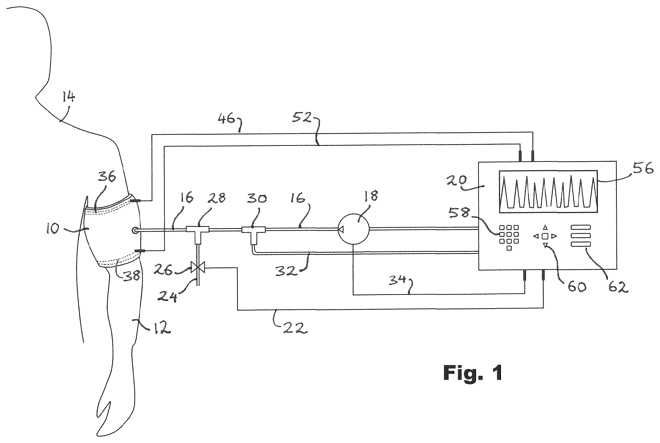 Patent US12376865 Figure 1 – Tourniquet assemblies and systems, and methods for controlling tourniquets