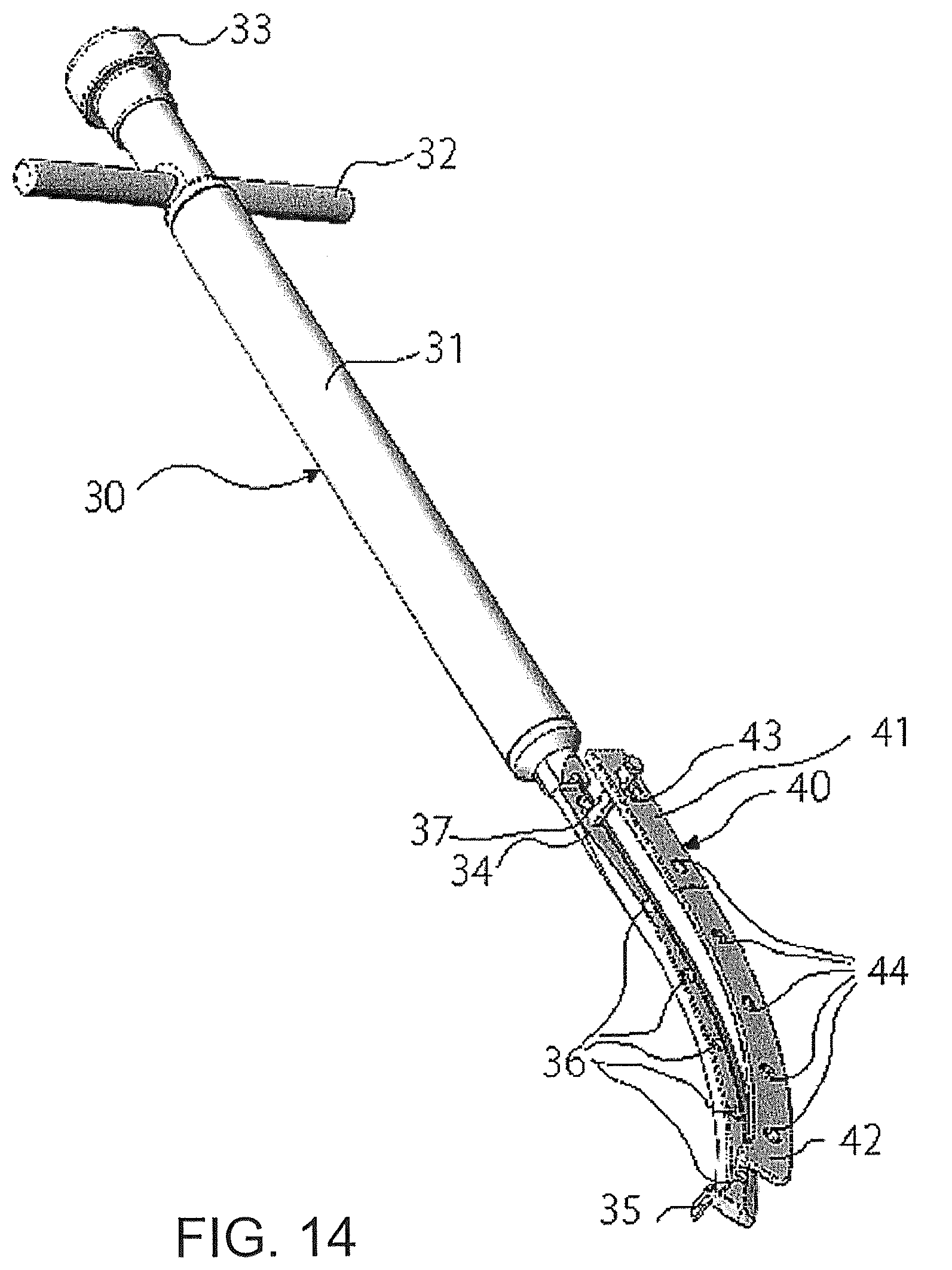Patent US12376866 Figure 14 – Thin-blade chisel system
